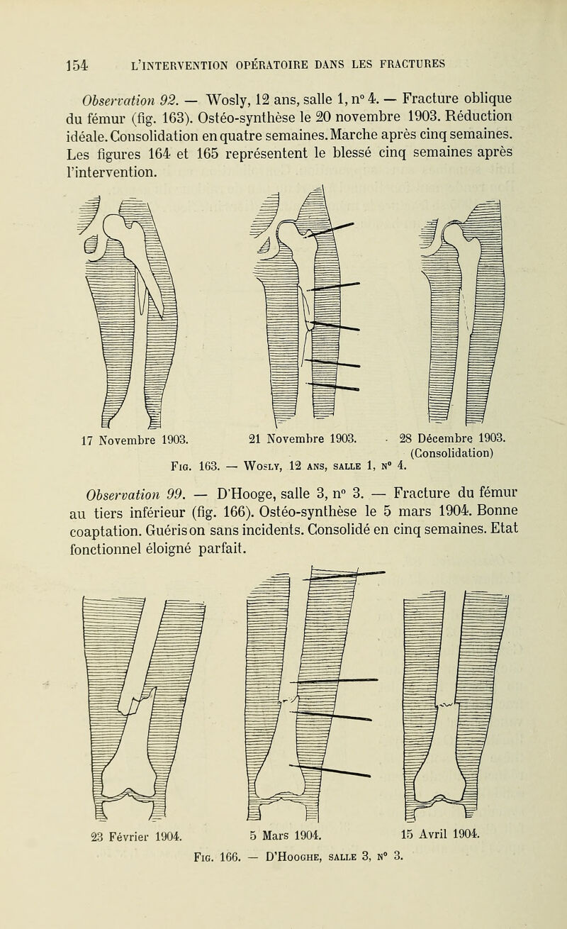 154 l'intervention opératoire dans les fractures Observation 92. — Wosly, 12 ans, salle 1, n° 4. — Fracture oblique du fémur (fig. 163). Ostéo-synthèse le 20 novembre 1903. Réduction idéale. Consolidation en quatre semaines. Marche après cinq semaines. Les figures 164 et 165 représentent le blessé cinq semaines après l'intervention. 17 Novembre 1903. 21 Novembre 1903. • 21 Fig. 163. — Wosly, 12 ans, salle 1, n» 4. ? Décembre 1903. (Consolidation) Observation 99. — D'Hooge, salle 3, n° 3. — Fracture du fémur au tiers inférieur (fig. 166). Ostéo-synthèse le 5 mars 1904. Bonne coaptation. Guéris on sans incidents. Consolidé en cinq semaines. Etat fonctionnel éloigné parfait. 23 Février 1904. 5 Mars 1904. 15 Avril 1904.