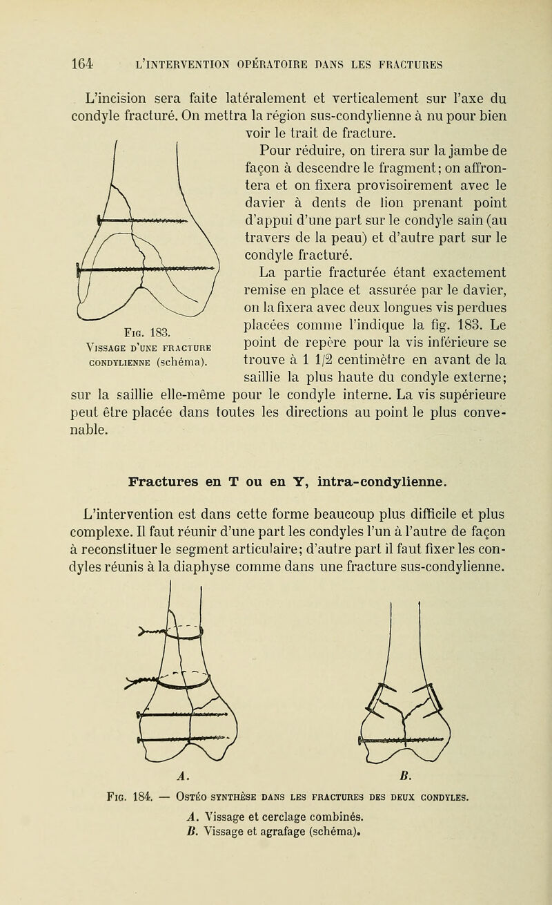 L'incision sera faite latéralement et verticalement sur l'axe du condyle fracturé. On mettra la région sus-condylienne à nu pour bien voir le trait de fracture. Pour réduire, on tirera sur la jambe de façon à descendre le fragment; on affron- tera et on fixera provisoirement avec le davier à dents de lion prenant point d'appui d'une part sur le condyle sain (au travers de la peau) et d'autre part sur le condyle fracturé. La partie fracturée étant exactement remise en place et assurée par le davier, on la fixera avec deux longues vis perdues placées comme l'indique la fig. 183. Le point de repère pour la vis inférieure se trouve à 1 1/2 centimètre en avant de la saillie la plus haute du condyle externe; sur la saillie elle-même pour le condyle interne. La vis supérieure peut être placée dans toutes les directions au point le plus conve- nable. Fig. 183. Vissage d'une fracture CONDYLIENNE (schéma). Fractures en T ou en Y, intra-condylienne. L'intervention est dans cette forme beaucoup plus difficile et plus complexe. Il faut réunir d'une part les condyles l'un à l'autre de façon à reconstituer le segment articulaire; d'autre part il faut fixer les con- dyles réunis à la diaphyse comme dans une fracture sus-condylienne. A. B. Fig. 184. — Ostéo synthèse dans les fractures bes deux condyles. A. Vissage et cerclage combinés. li. Vissage et agrafage (schéma).