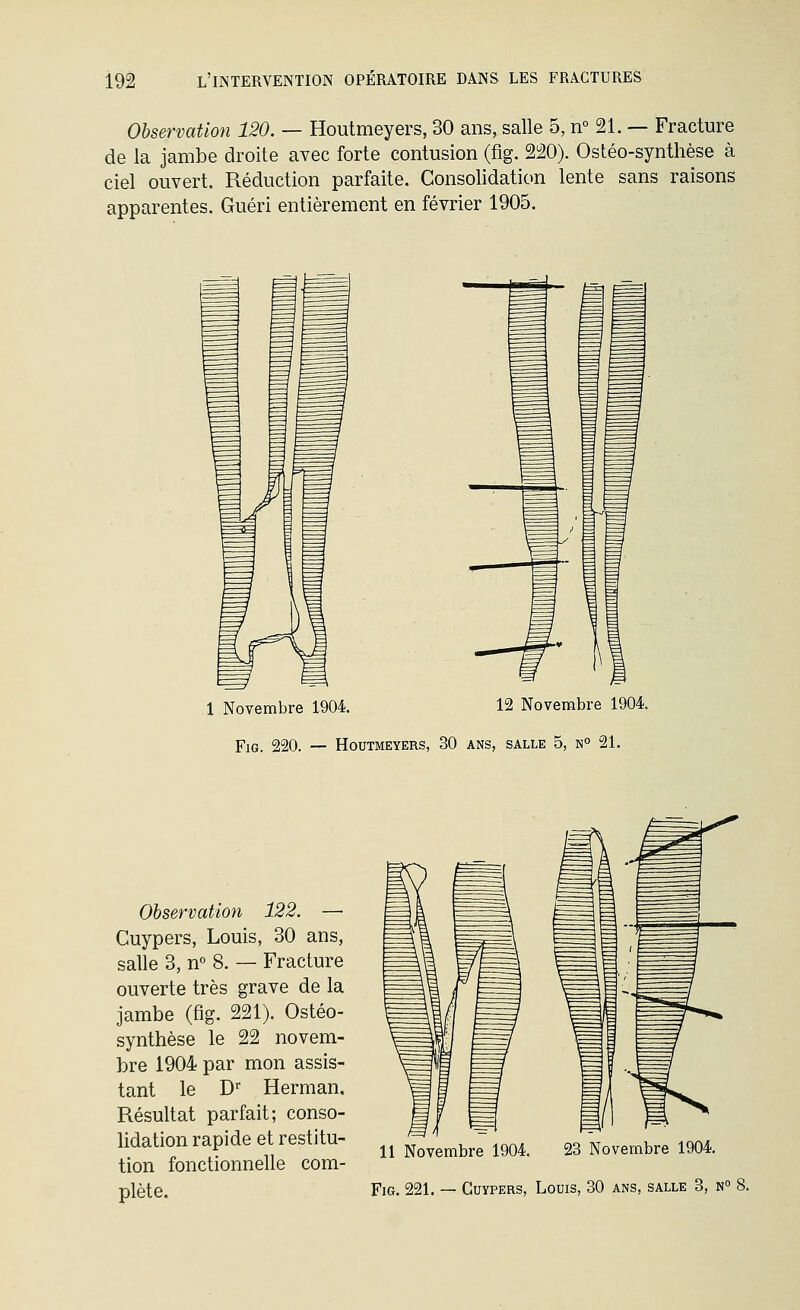 Observation 120. — Houtmeyers, 30 ans, salle 5, n° 21. — Fracture de la jambe droite avec forte contusion (fig. 220). Ostéo-synthèse à ciel ouvert. Réduction parfaite. Consolidation lente sans raisons apparentes. Guéri entièrement en février 1905. 1 Novembre 1904. 12 Novembre 1904. Fig. 220. — Houtmeykrs, 30 ans, salle 5, no 21. Observation 122. — Cuypers, Louis, 30 ans, salle 3, n° 8. — Fracture ouverte très grave de la jambe (fig. 221). Ostéo- synthèse le 22 novem- bre 1904 par mon assis- tant le D' Herman. Fœsultat parfait; conso- lidation rapide et restitu- tion fonctionnelle com- plète. 11 Novembre 1904. 23 Novembre 1904.