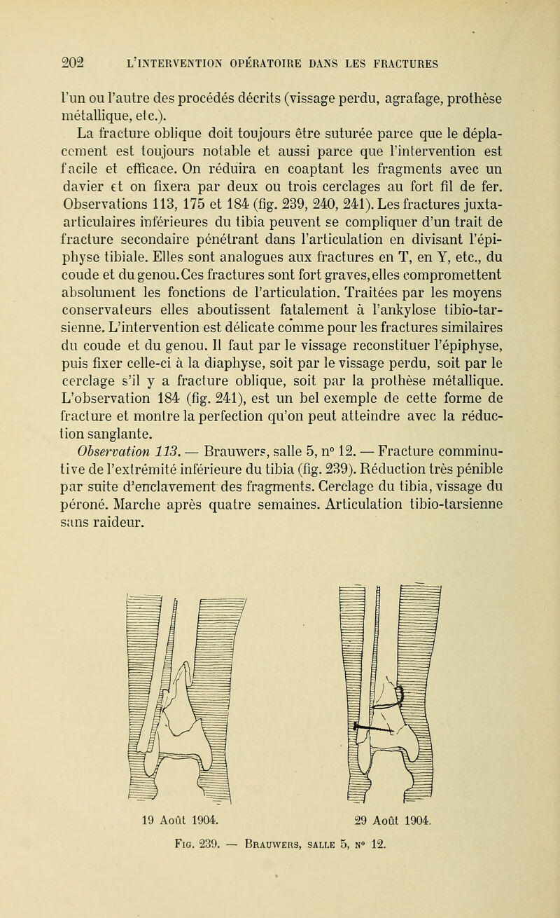 l'un OU l'autre des procédés décrits (vissage perdu, agrafage, prothèse métallique, etc.). La fracture oblique doit toujours être suturée parce que le dépla- cement est toujours notable et aussi parce que l'intervention est facile et efficace. On réduira en coaptant les fragments avec un davier et on fixera par deux ou trois cerclages au fort fil de fer. Observations 113, 175 et 184 (fig. 239, 240, 241). Les fractures juxta- articulaires inférieures du tibia peuvent se compliquer d'un trait de fracture secondaire pénétrant dans l'articulation en divisant l'épi- physe tibiale. Elles sont analogues aux fractures en T, en Y, etc., du coude et du genou.Ces fractures sont fort graves,elles compromettent absolument les fonctions de l'articulation. Traitées par les moyens conservateurs elles aboutissent fatalement à l'ankylose tibio-tar- sienne. L'intervention est délicate comme pour les fractures similaires du coude et du genou. Il faut par le vissage reconstituer l'épiphyse, puis fixer celle-ci à la diaphyse, soit par le vissage perdu, soit par le cerclage s'il y a fracture oblique, soit par la prothèse métallique. L'observation 184 (fig. 241), est un bel exemple de cette forme de fracture et montre la perfection qu'on peut atteindre avec la réduc- tion sanglante. Observation 113. — Brauwers, salle 5, n 12. — Fracture comminu- tive de l'extrémité inférieure du tibia (fig. 239). Réduction très pénible par suite d'enclavement des fragments. Cerclage du tibia, vissage du péroné. Marche après quatre semaines. Articulation tibio-tarsienne sans raideur. 19 Août 1904. 29 Août 1904. Fig. 239. — Brauwers, salle 5, n» 12.