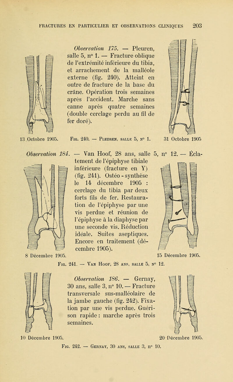 13.Octobre 1905. Observation 175. — Pleuren, salle 5, n° 1. — Fracture oblique de l'extrémité inférieure du tibia, et arrachement de la malléole externe (fig. 240). Atteint en outre de fracture de la base du crâne. Opération trois semaines après l'accident. Marche sans canne après quatre semaines (double cerclage perdu au fil de fer doré). Fig. 240. — Pleuren, salle 5, n 1. 31 Octobre 1905 Observation 184. — Van Hoof, 28 ans, salle 5, n° 12 tement de l'épiphyse tibiale inférieure (fracture en Y) (fig. 241). Ostéo - synthèse le 14 décembre 1905 : cerclage du tibia par deux forts fils de fer. Restaura- tion de l'épiphyse par une vis perdue et réunion de l'épiphyse à la diaphyse par une seconde vis. Réduction idéale. Suites aseptiques. Encore en traitement (dé- cembre 1905). Ecla- 8 Décembre 1905. 15 Décembre 1905. Fig. 241, — Van Hoof, 28 ans, salle 5, n 12. Observation 186. — Gernay, 30 ans, salle 3, n° 10. — Fracture transversale sus-malléolaire de la jambe gauche (fig. 242). Fixa- tion par une vis perdue. Guéri- son rapide : marche après trois semaines. 10 Décembre 1905. 20 Décembre 1905.