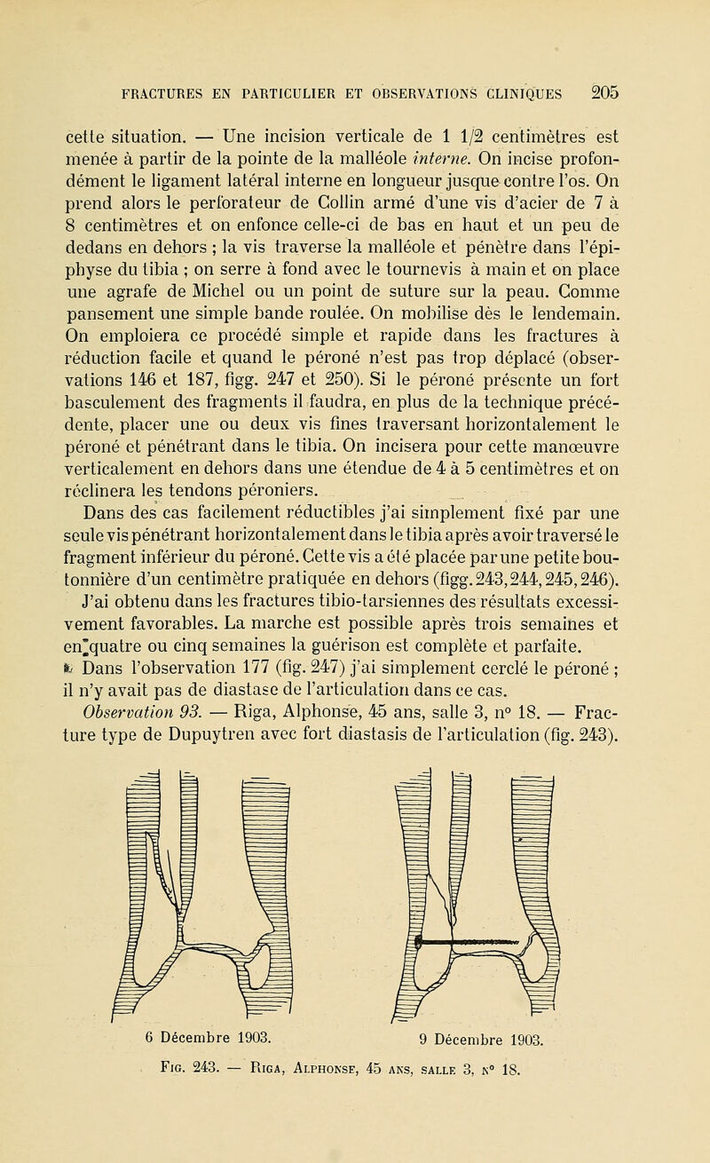 cette situation. — Une incision verticale de 1 1/2 centimètres est menée à partir de la pointe de la malléole interne. On incise profon- dément le ligament latéral interne en longueur jusque contre l'os. On prend alors le perforateur de Gollin armé d'une vis d'acier de 7 à 8 centimètres et on enfonce celle-ci de bas en haut et un peu de dedans en dehors ; la vis traverse la malléole et pénètre dans l'épi- physe du tibia ; on serre à fond avec le tournevis à main et on place une agrafe de Michel ou un point de suture sur la peau. Comme pansement une simple bande roulée. On mobilise dès le lendemain. On emploiera ce procédé simple et rapide dans les fractures à réduction facile et quand le péroné n'est pas trop déplacé (obser- vations 146 et 187, figg. 247 et 250). Si le péroné présente un fort basculement des fragments il faudra, en plus de la technique précé- dente, placer une ou deux vis fines traversant horizontalement le péroné et pénétrant dans le tibia. On incisera pour cette manœuvre verticalement en dehors dans une étendue de 4 à 5 centimètres et on réclinera les tendons péroniers. Dans des cas facilement réductibles j'ai simplement fixé par une seule vis pénétrant horizontalement dans le tibia après avoir traversé le fragment inférieur du péroné. Cette vis a été placée par une petite bou- tonnière d'un centimètre pratiquée en dehors (figg. 243,244,245,246). J'ai obtenu dans les fractures tibio-tarsiennes des résultats excessi- vement favorables. La marche est possible après trois semaines et en^quatre ou cinq semaines la guérison est complète et parfaite. it' Dans l'observation 177 (fig. 247) j'ai simplement cerclé le péroné ; il n'y avait pas de diastase de l'articulation dans ce cas. Observation 93. — Riga, Alphonse, 45 ans, salle 3, n° 18. — Frac- ture type de Dupuytren avec fort diastasis de l'articulation (fig. 243). 6 Décembre 1903. 9 Décembre 1903. Fig. 243. — Riga, Alphonse, 45 ans, salle 3, k» 18.