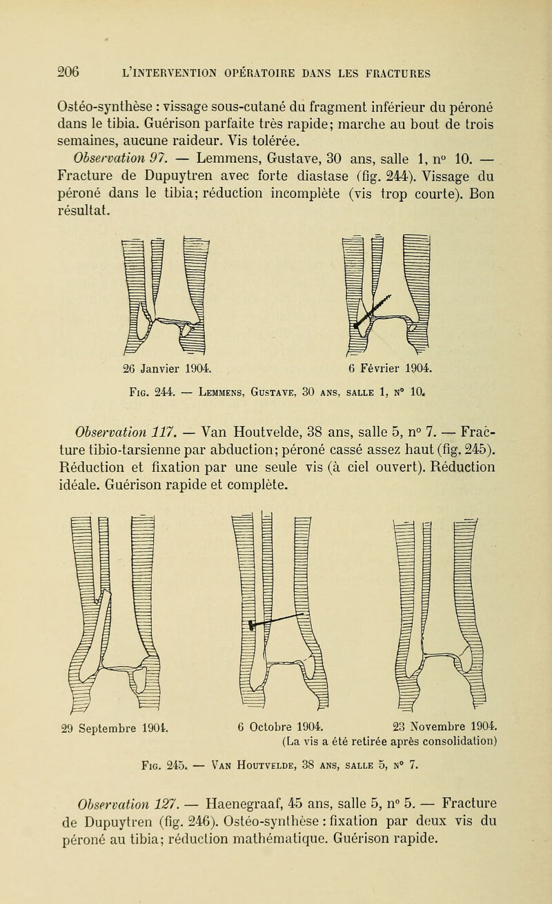 Ostéo-synthèse : vissage sous-cutané du fragment inférieur du péroné dans le tibia. Guérison parfaite très rapide; marche au bout de trois semaines, aucune raideur. Vis tolérée. Observation 97. — Lemmens, Gustave, 30 ans, salle 1, n 10. — Fracture de Dupuytren avec forte diastase (fig. 244). Vissage du péroné dans le tibia; réduction incomplète (vis trop courte). Bon résultat. 26 Janvier 1904. 6 Février 1904. Fig. 244. — Lemmens, Gustave, 30 ans, salle 1, n 10. Observation 117. — Van Houtvelde, 38 ans, salle 5, n° 7. — Frac- ture tibio-tarsienne par abduction; péroné cassé assez haut (fig. 245). Réduction et fixation par une seule vis (à ciel ouvert). Réduction idéale. Guérison rapide et complète. 29 Septembre 1904. 6 Octobre 1904. 23 Novembre 1904. (La vis a été retirée après consolidation) FiG. 245. — Van Houtvelde, 38 ans, salle 5, n° 7. Observation 127. — Haenegraaf, 45 ans, salle 5, n 5, — Fracture de Dupuytren (fig. 246). Ostéo-synthèse : fixation par deux vis du péroné au tibia; réduction mathématique. Guérison rapide.