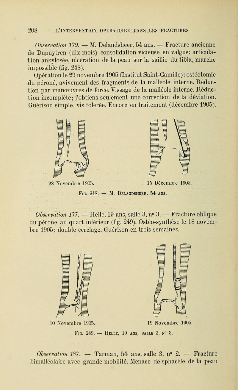 Observation 179. — M. Delandsheer, 54 ans. — Fracture ancienne de Dupuytren (dix mois) consolidation vicieuse en valgus ; articula- tion ankylosée, ulcération de la peau sur la saillie du tibia, marche impossible (fig. 248). Opération le 29 novembre 1905 (Institut Saint-Camille): ostéotomie du péroné, avivement des fragments de la malléole interne. Réduc- tion par manœuvres de force. Vissage de la malléole interne. Réduc- tion incomplète; j'obtiens seulement une correction de la déviation. Guérison simple, vis tolérée. Encore en traitement (décembre 1905). 28 Novembre 1905. ' 15 Décembre 1905. Fig. 248. — M. Delandsheer, 54 ans. Observation 177. — Helle, 19 ans, salle 3,no 3. — Fracture oblique du péroné au quart inférieur (fig. 249). Ostéo-synlhèse le 18 novem- bre 1905; double cerclage. Guérison en trois semaines. 10 Novembre 1905. 19 Novembre 1905. Fig. 249. — Helle, 19 ans, salle 3, n° 3. Observation 187. — Tarman, 54 ans, salle 3, n° 2. — Fracture bimalléolaire avec grande mobilité. Menace de sphacèle de la peau