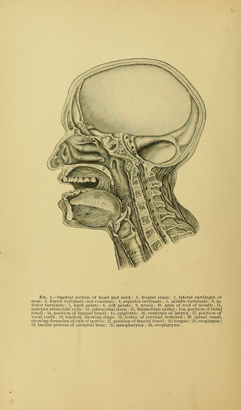 nose; 3, fourth turbinate (not constant); 4, superior turbinate ; 5, middle turbinate ; 6, in- ferior turbinate; 7, hard palate; 8, soft palate; 9, uvula; 10, arch of roof of mouth; 11, anterior ethmoidal cells; 12, sphenoidal sinus; 13, Eustachian orifice ; 13a, position of tubal tonsil; 14, position of lingual tonsil; 15, epiglottis ; 16, vestibule of laryux ; 17, position of vocal cords; 18, trachea, showing rings; 19, bodies of cervical vertebrae; 20, spinal canal, showing foramina of exit of nerves; 21, position of faucial tonsil; 22, tongue ; 23, esophagus ; 24, basilar process of occipital bone; 25, nasopharynx ; 26, oropharynx.