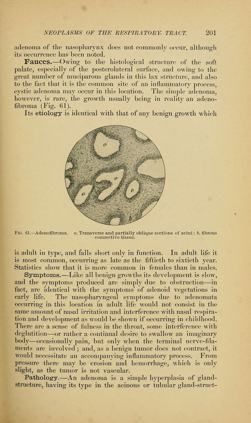 adenoma of the nasopharynx does not commonly occur, although its occurrence has been noted. Fauces.—Owing to the histological structure of the soft palate, especially of the posterolateral surface, and owing to the great number of muciparous glands in this lax structure, and also to the fact that it is the common site of an inflammatory process, cystic adenoma may occur in this location. The simple adenoma, however, is rare, the growth usually being in reality an adeno- fibroma (Fig. 61). Its etiology is identical with that of any benign growth which Fig. 61.—Adenofibroma. a. Transverse and partially oblique sections of acini; b, fibrous connective tissue. is adult in type, and falls short only in function. In adult life it is most common, occurring as late as the fiftieth to sixtieth year. Statistics show that it is more common in females than in males. Symptoms.—Like all benign growths its development is slow, and the symptoms produced are simply due to obstruction—in fact, are identical with the symptoms' of adenoid vegetations in early life. The nasopharyngeal symptoms due to adenomata occurring in this location in adult life would not consist in the same amount of nasal irritation and interference with nasal respira- tion and development as would be shown if occurring in childhood. There are a sense of fulness in the throat, some interference with deglutition—or rather a continual desire to swallow an imaginary body—occasionally pain, but only when the terminal nerve-fila- ments are involved; and, as a benign tumor does not contract, it would necessitate an accompanying inflammatory process. From pressure there may be erosion and hemorrhage, which is only slight, as the tumor is not vascular. Pathology.—An adenoma is a simple hyperplasia of gland- structure, having its type in the acinous or tubular gland-struct-