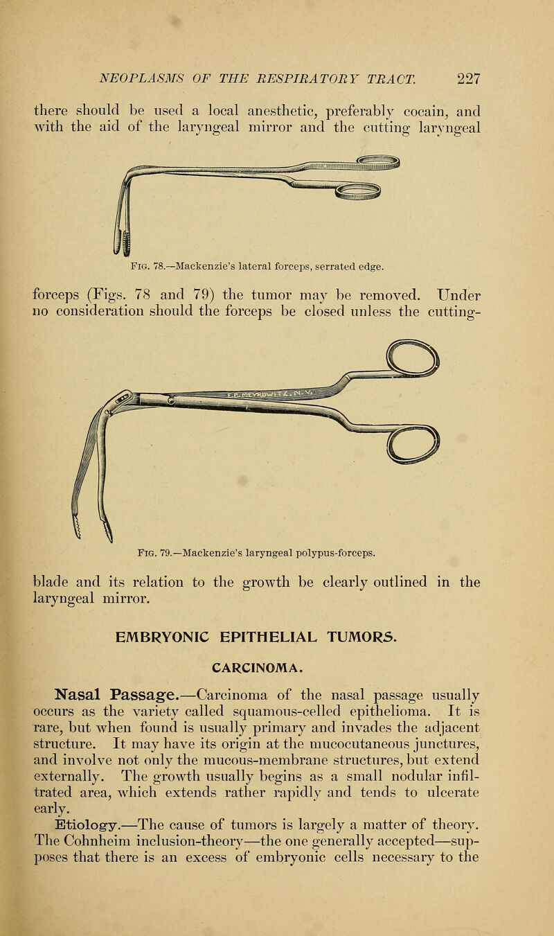 there should be used a local anesthetic, preferably cocain, and with the aid of the laryngeal mirror and the cutting laryngeal Fig. 78.—Mackenzie's lateral forceps, serrated edge. forceps (Figs. 78 and 79) the tumor may be removed. Under no consideration should the forceps be closed unless the cutting- Fig. 79.—Mackenzie's laryngeal polypus-forceps. blade and its relation to the growth be clearly outlined in the laryngeal mirror. EMBRYONIC EPITHELIAL TUMORS. CARCINOMA. Nasal Passage.—Carcinoma of the nasal passage usually occurs as the variety called squamous-celled epithelioma. It is rare, but when found is usually primary and invades the adjacent structure. It may have its origin at the mucocutaneous junctures, and involve not only the mucous-membrane structures, but extend externally. The growth usually begins as a small nodular infil- trated area, which extends rather rapidly and tends to ulcerate early. Etiology.—The cause of tumors is largely a matter of theory. The Cohnheim inclusion-theory—the one generally accepted—sup- poses that there is an excess of embryonic cells necessary to the