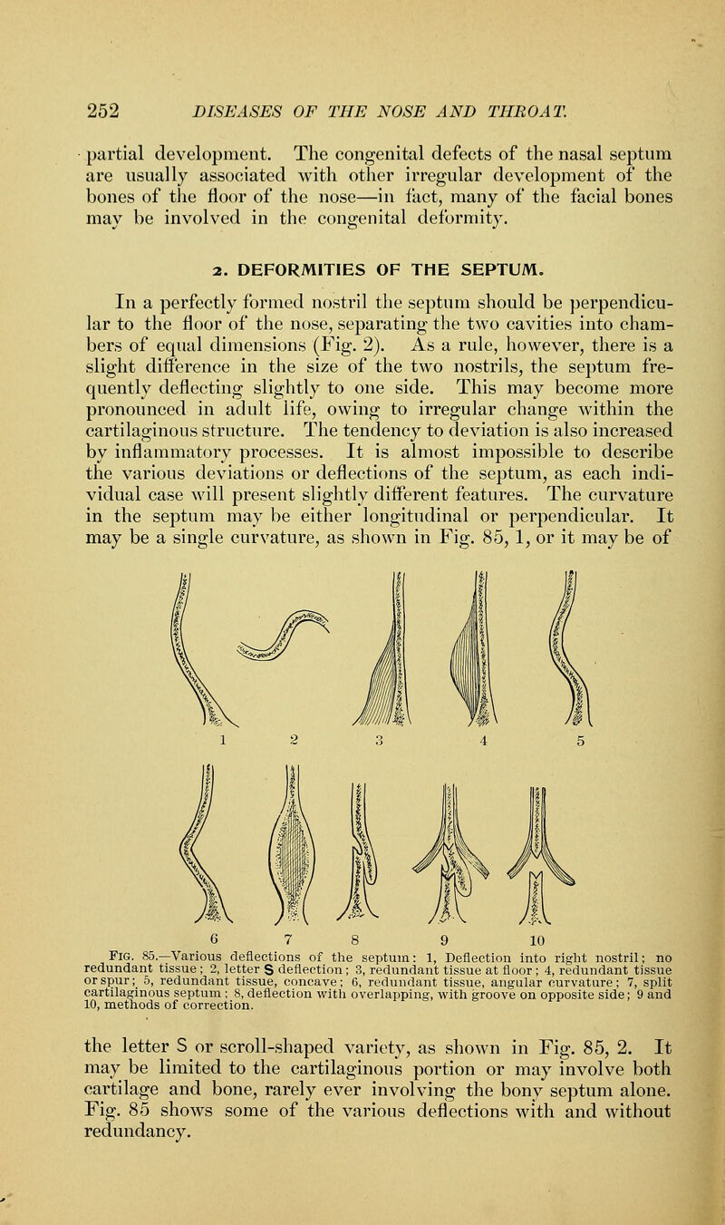 partial development. The congenital defects of the nasal septum are usually associated with other irregular development of the bones of the floor of the nose—in fact, many of the facial bones may be involved in the congenital deformity. 2. DEFORMITIES OF THE SEPTUM. In a perfectly formed nostril the septum should be perpendicu- lar to the floor of the nose, separating the two cavities into cham- bers of equal dimensions (Fig. 2). As a rule, however, there is a slight difference in the size of the two nostrils, the septum fre- quently deflecting slightly to one side. This may become more pronounced in adult life, owing to irregular change within the cartilaginous structure. The tendency to deviation is also increased by inflammatory processes. It is almost impossible to describe the various deviations or deflections of the septum, as each indi- vidual case will present slightly different features. The curvature in the septum may be either longitudinal or perpendicular. It may be a single curvature, as shown in Fig. 85, 1, or it may be of 9 10 Fig. 85.—Various deflections of the septum: 1, Deflection into right nostril; no redundant tissue ; 2, letter S deflection; 3, redundant tissue at floor; 4, redundant tissue or spur; 5, redundant tissue, concave; 6, redundant tissue, angular curvature; 7, split cartilaginous septum ; 8, deflection with overlapping, with groove on opposite side; 9 and 10, methods of correction. the letter S or scroll-shaped variety, as shown in Fig. 85, 2. It may be limited to the cartilaginous portion or may involve both cartilage and bone, rarely ever involving the bony septum alone. Fig. 85 shows some of the various deflections with and without redundancy.
