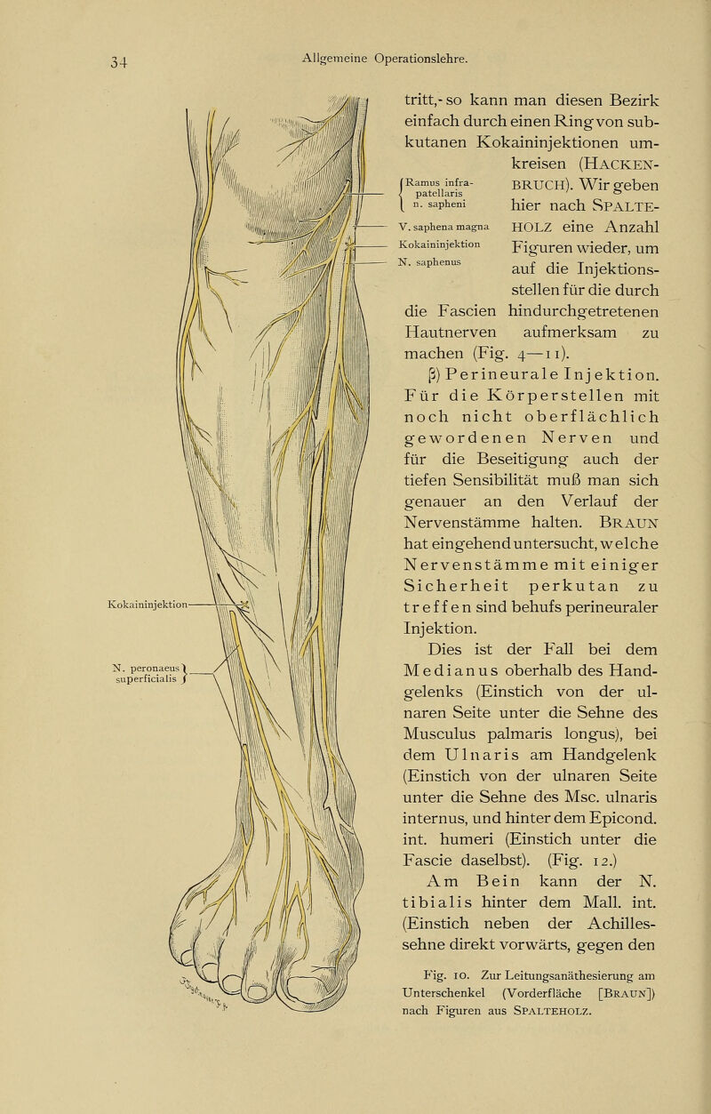 fRamus infra- / patellaris I n. sapheni V. saphena magna Kokaininjektion N. saphenus tritt,-so kann man diesen Bezirk einfach durch einen Ring von sub- kutanen Kokaininjektionen um- kreisen (Hacken- bruch). Wir geben hier nach SpALTE- HOLZ eine Anzahl Figuren wieder, um auf die Injektions- stellen für die durch die Fascien hindurchgetretenen Hautnerven aufmerksam zu machen (Fig. 4—11). ß) Perineurale Injektion. Für die Körperstellen mit noch nicht oberflächlich gewordenen Nerven und für die Beseitigung auch der tiefen Sensibilität muß man sich genauer an den Verlauf der Nervenstämme halten. Braun hat eingehenduntersucht, welche Nervenstämme mit einiger Sicherheit perkutan zu treffen sind behufs perineuraler Injektion. Dies ist der Fall bei dem M e d i a n u s oberhalb des Hand- gelenks (Einstich von der ul- naren Seite unter die Sehne des Musculus palmaris longus), bei dem Ulnaris am Handgelenk (Einstich von der ulnaren Seite unter die Sehne des Msc. ulnaris internus, und hinter dem Epicond. int. humeri (Einstich unter die Fascie daselbst). (Fig. 12.) Am Bein kann der N. tibialis hinter dem Mall. int. (Einstich neben der Achilles- sehne direkt vorwärts, gegen den Fig. 10. Zur Leitungsanäthesierung am Unterschenkel (Vorderfläche [Braun]) nach Figuren aus Spalteholz.