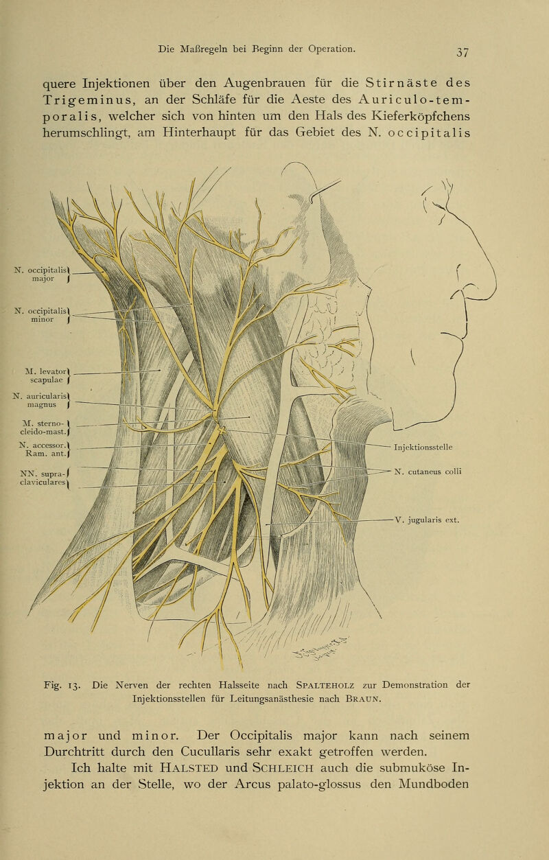 quere Injektionen über den Augenbrauen für die Stirnäste des Trigeminus, an der Schläfe für die Aeste des Auriculo-tem- poralis, welcher sich von hinten um den Hals des Kieferköpfchens herumschlingt, am Hinterhaupt für das Gebiet des N. occipitalis V. jugularis ext. Fig. 13. Die Nerven der rechten Halsseite nach Spalteholz zur Demonstration der Injektionsstellen für Leitungsanästhesie nach Braun. major und minor. Der Occipitalis major kann nach seinem Durchtritt durch den Cucullaris sehr exakt getroffen werden. Ich halte mit Halsted und Schleich auch die submuköse In- jektion an der Stelle, wo der Arcus palato-glossus den Mundboden