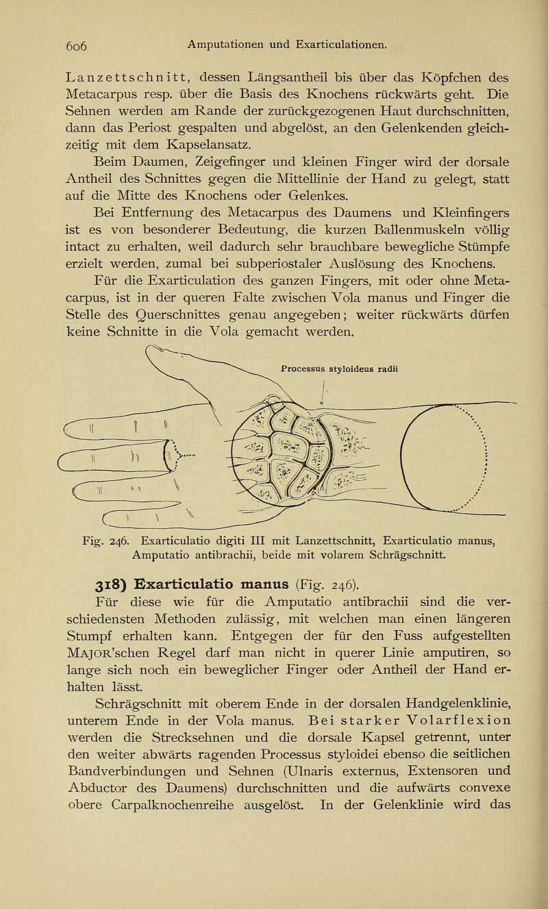 Lanzettschnitt, dessen Längsantheil bis über das Köpfchen des Metacarpus resp. über die Basis des Knochens rückwärts geht. Die Sehnen werden am Rande der zurückgezogenen Haut durchschnitten, dann das Periost gespalten und abgelöst, an den Gelenkenden gleich- zeitig mit dem Kapselansatz. Beim Daumen, Zeigefinger und kleinen Finger wird der dorsale Antheil des Schnittes gegen die Mittellinie der Hand zu gelegt, statt auf die Mitte des Knochens oder Gelenkes. Bei Entfernung des Metacarpus des Daumens und Kleinfingers ist es von besonderer Bedeutung, die kurzen Ballenmuskeln völlig intact zu erhalten, weil dadurch sehr brauchbare bewegliche Stümpfe erzielt werden, zumal bei subperiostaler Auslösung des Knochens. Für die Exarticulation des ganzen Fingers, mit oder ohne Meta- carpus, ist in der queren Falte zwischen Vola manus und Finger die Stelle des Querschnittes genau angegeben; weiter rückwärts dürfen keine Schnitte in die Vola gemacht werden. tyloideus radii Fig. 246. Exarticulatio digiti III mit Lanzettschnitt, Exarticulatio manus, Amputatio antibrachii, beide mit volarem Schrägschnitt. 318) Exarticulatio manus (Fig. 246). Für diese wie für die Amputatio antibrachii sind die ver- schiedensten Methoden zulässig, mit welchen man einen längeren Stumpf erhalten kann. Entgegen der für den Fuss aufgestellten MAjOR'schen Regel darf man nicht in querer Linie amputiren, so lange sich noch ein beweglicher Finger oder Antheil der Hand er- halten lässt. Schrägschnitt mit oberem Ende in der dorsalen Handgelenklinie, unterem Ende in der Vola manus. Bei starker Volarflexion werden die Strecksehnen und die dorsale Kapsel getrennt, unter den weiter abwärts ragenden Processus styloidei ebenso die seitlichen Bandverbindungen und Sehnen (Ulnaris externus, Extensoren und Abductor des Daumens) durchschnitten und die aufwärts convexe obere Carpalknochenreihe ausgelöst. In der Gelenklinie wird das