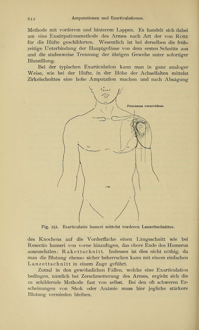 Methode mit vorderem und hinterem Lappen. Es handelt sich dabei um eine Exstirpationsmethode des Armes nach Art der von Rose für die Hüfte geschilderten. Wesentlich ist bei derselben die früh- zeitige Unterbindung der Hauptgefässe von dem ersten Schnitte aus und die stufenweise Trennung der übrigen Gewebe unter sofortiger Blutstillung. Bei der typischen Exarticulation kann man in ganz analoger Weise, wie bei der Hüfte, in der Höhe der Achselfalten mittelst Zirkelschnittes eine hohe Amputation machen und nach Absägung Processus coracoideus Fig. 252. Exarticulatio humeri mittelst vorderen Lanzettschnittes. des Knochens auf die Vorderfläche einen Längsschnitt wie bei Resectio humeri von vorne hinzufügen, das obere Ende des Humerus auszuschälen: Rakettschnitt. Indessen ist dies nicht nöthig, da man die Blutung ebenso sicher beherrschen kann mit einem einfachen Lanzettschnitt in einem Zuge geführt. Zumal in den gewöhnlichen Fällen, welche eine Exarticulation bedingen, nämlich bei Zerschmetterung des Armes, ergiebt sich die zu schildernde Methode fast von selbst. Bei den oft schweren Er- scheinungen von Shok oder Anämie muss hier jegliche stärkere Blutung vermieden bleiben.