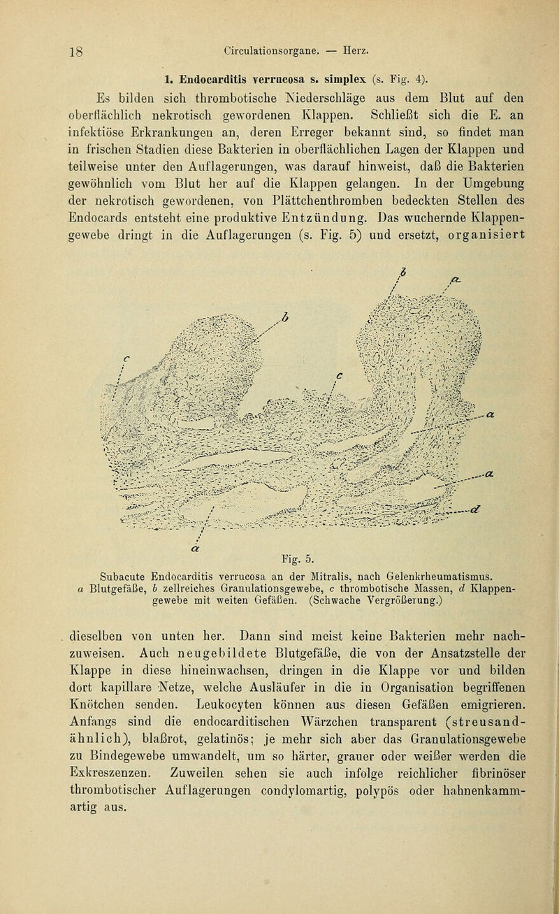 1. Endocarditis verracosa s. simples (s. Fig. 4). Es bilden sich thrombotische Niederschläge aus dem Blut auf den oberflächlich nekrotisch gewordenen Klappen. Schließt sich die E. an infektiöse Erkrankungen an, deren Erreger bekannt sind, so findet man in frischen Stadien diese Bakterien in oberflächlichen Lagen der Klappen und teilweise unter den Auflagerungen, was darauf hinweist, daß die Bakterien gewöhnlich vom Blut her auf die Klappen gelangen. In der Umgebung der nekrotisch gewordenen, von Plättchenthromben bedeckten Stellen des Endocards entsteht eine produktive Entzündung. Das wuchernde Klappen- gewebe dringt in die Auflagerungen (s. Fig. 5) und ersetzt, organisiert ,b §Wi0^^:':':''^^^%-. ||;())St/: '■•■'.':'-4$ '-\.,--':'.'4' c ■.'■■■,''■',, ■■ E» :^^>>;?^- :,';^-VT ., ...■Ä^--',y'. '• '■:'••■ .-■OL J^^- d Fig. 5. Subacute Endocarditis verrucosa an der Mitralis, nach Gelenkrheumatismus. a Blutgefäße, 6 zellreiches Granulationsgewebe, c thrombotische Massen, d Klappen- gewebe mit weiten Gefällen. (Schwache Vergrößerung.) dieselben von unten her. Dann sind meist keine Bakterien mehr nach- zuweisen. Auch neugebildete Blutgefäße, die von der Ansatzstelle der Klappe in diese hineinwachsen, dringen in die Klappe vor und bilden dort kapillare Netze, welche Ausläufer in die in Organisation begriffenen Knötchen senden. Leukocyten können aus diesen Gefäßen emigrieren. Anfangs sind die endocarditischen Wärzchen transparent (streusand- ähnlich), blaßrot, gelatinös; je mehr sich aber das Granulationsgewebe zu Bindegewebe umwandelt, um so härter, grauer oder weißer werden die Exkreszenzen. Zuweilen sehen sie auch infolge reichlicher fibrinöser thrombotischer Auflagerungen condylomartig, polypös oder hahnenkamm- artig aus.