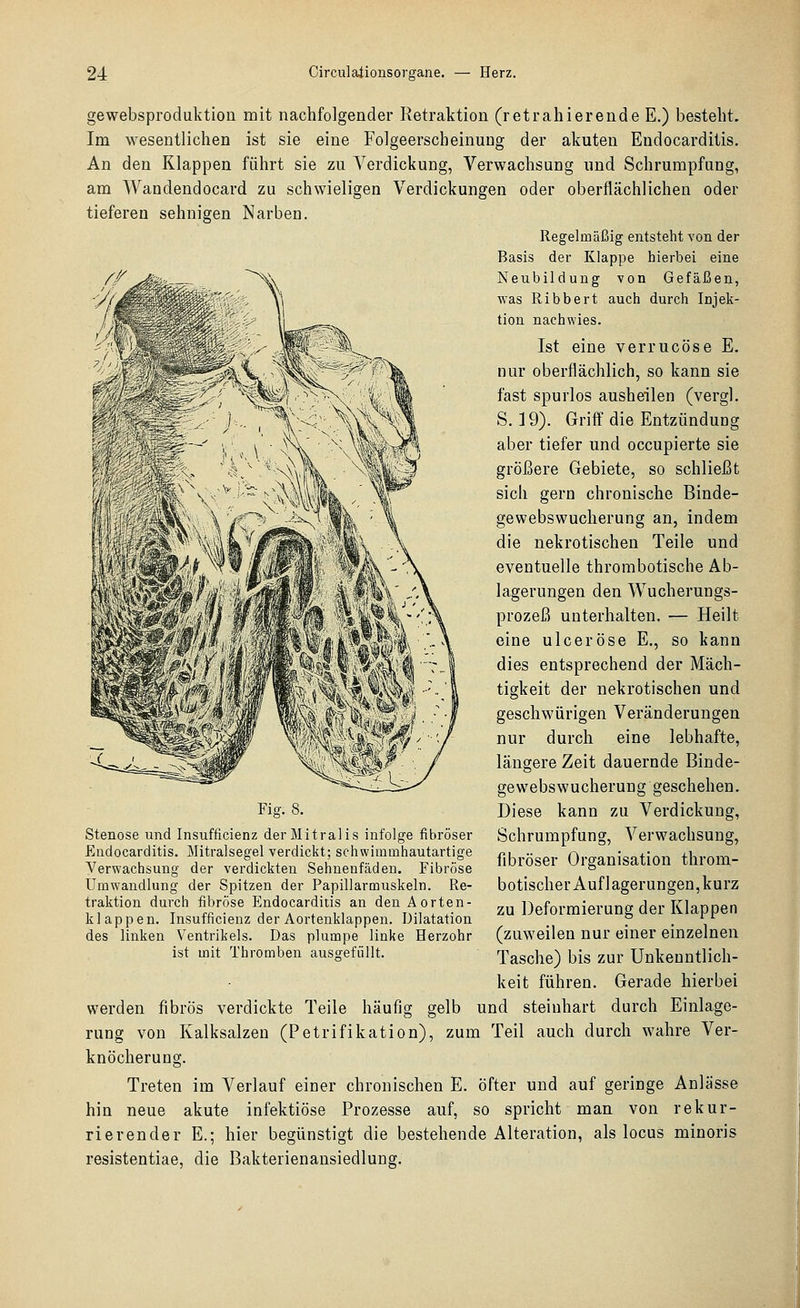 gewebsproduktion mit nachfolgender Retraktion (retrahierende E.) bestellt. Im wesentlichen ist sie eine Folgeerscheinung der akuten Eudocarditis. An den Klappen führt sie zu Verdickung, Verwachsung und Schrumpfung, am Wandendocard zu schwieligen Verdickungen oder oberflächlichen oder tieferen sehnigen Narben. Regelmäßig entsteht von der Basis der Klappe hierbei eine Neubildung von Gefäßen, was Ribbert auch durch Injek- tion nachwies. Ist eine verrucöse E. nur oberflächlich, so kann sie fast spurlos ausheilen (vergl, S. 19). Griff die Entzündung aber tiefer und occupierte sie größere Gebiete, so schließt sich gern chronische Binde- gewebswucherung an, indem die nekrotischen Teile und eventuelle thrombotische Ab- lagerungen den Wucherungä- prozeß unterhalten. — Heilt eine ulceröse E., so kann dies entsprechend der Mäch- tigkeit der nekrotischen und geschwürigen Veränderungen nur durch eine lebhafte, längere Zeit dauernde Binde- gewebswucherung geschehen. Diese kann zu Verdickung, Schrumpfung, Verwachsung, fibröser Organisation throm- botischer Auflagerungen, kurz zu Deformierung der Klappen (zuweilen nur einer einzelnen Tasche) bis zur Unkenntlich- keit führen. Gerade hierbei werden fibrös verdickte Teile häufig gelb und steinhart durch Einlage- rung von Kalksalzen (Petrifikation), zum Teil auch durch wahre Ver- knöcherung. Treten im Verlauf einer chronischen E. öfter und auf geringe Anlässe hin neue akute infektiöse Prozesse auf, so spricht man von rekur- rierender E.; hier begünstigt die bestehende Alteration, als locus minoris resistentiae, die Bakterienansiedlung. Fig. 8. Stenose und Insufficienz derMitralis infolge fibröser Endocarditis. Mitralsegel verdickt; schwimmhautartige Verwachsung der verdickten Sehnenfäden. Fibröse Umwandlung der Spitzen der Papillarmuskeln. Re- traktion durch fibröse Endocarditis an den Aorten- klappen. Insufficienz der Aortenklappen. Dilatation des linken Ventrikels. Das plumpe linke Herzohr ist mit Thromben ausgefüllt.