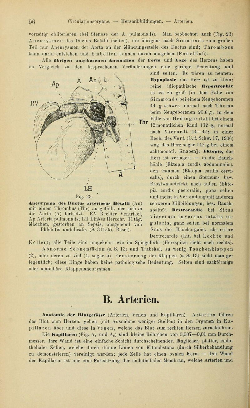 Thr vorzeitig obliterieren (bei Stenose der A. pulmonalis). Man beobachtet auch (Fig. 23) Aneurysmen des Ductus Botalli (selten), die übrigens nach Simmonds zum großen Teil nur Aneurysmen der Aorta an der Mündungsstelle des Ductus sind; Thrombose kann darin entstehen und Embolien können davon ausgehen (Rauchfuß). Alle übrigen angeborenen Anomalien der Form und Lage des Herzens haben im Vergleich zu den besprochenen Veränderungen eine geringe Bedeutung und sind selten. Es wären zu nennen: Hypoplasie das Herz ist zu klein; reine idiopathische Hypertrophie es ist zu groß [in dem Falle von Simmonds bei einem Neugeborenen 44 g schwer, normal nach Thoma beim Neugeborenen 20,6 g; in dem Falle von Hedinger (Lit.) bei einem 15 monatlichen Kind 132 g, normal nach Vierordt 44—47; in einer Beob. des Verf. (C. f. Schw. 17, 1906) W'Og das Herz sogar 142 g bei einem achtmonatl. Knaben]; Ektopie, das Herz ist verlagert — in die Bauch- höhle (Ektopia cordis abdominalis), den Gaumen (Ektopia cordis cervi- calis), durch einen Sternum- bzw. Brustwanddefekt nach außen (Ekto- pia cordis pectoralis, ganz selten und meist in Verbindung mit anderen schweren Mißbildungen, bes. ßauch- spalte); Dextrocardie bei Situs viscerum inversus totalis re- gularis, ganz selten bei normalem Situs der Bauchorgane, als reine LH Fig. 23. Aneurysma des Ductus arteriosus Botalli (An) mit einem Thrombus (Thr) ausgefüllt, der sich in die Aorta (A) fortsetzt. RV Rechter Ventrikel, Ap Arteria pulmonalis, LH Linkes Herzohr. 11 tag. Mädchen, gestorben an Sepsis, ausgehend von Phlebitis umbilicalis (S. 311,05, Basel). Dextrocardie (Lit. bei Lochte und Koller); alle Teile sind umgekehrt wie im Spiegelbild (Herzspitze sieht nach rechts). Abnorme Sehnenfäden (s. S. 13) und Trabekel, zu wenig Taschenklappen (2), oder deren zu viel (4, sogar 5), Fensterung der Klappen (s. S. 13) sieht man ge- legentlich; diese Dinge haben keine pathologische Bedeutung. Selten sind sackförmige oder ampiilläre Klappenaneurysmen. B. Arterien. Anatomie der Blutgefässe (Arterien, Venen und Kapillaren). Arterien führen das Blut zum Herzen, gehen (mit Ausnahme weniger Stellen) in den Organen in Ka- pillaren über und diese in Venen, welche das Blut zum rechten Herzen zurückführen. Die Kapillaren (Fig. Aj und A2) sind kleine Röhrchen von 0,007—0,01 mm Durch- messer. Ihre Wand ist eine einfache Schicht durchscheinender, länglicher, platter, endo- thelialer Zellen, welche durch dünne Linien von Kittsubstanz (durch Silberbehandlung zu demonstrieren) vereinigt werden; jede Zelle hat einen ovalen Kern. — Die Wand der Kapillaren ist nur eine Fortsetzung der endothelialen Membran, welche Arterien und