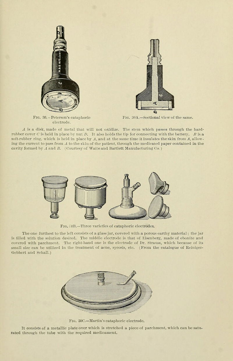 Fig. 30.—Peterson's cataphoric electrode. Fig. SOA.—Sectional view of the same. ^ is a disk, made of raetal that will not oxidize. The stem which passes through the hard- rubber cover C is held in place by nut D. It also holds the tip for connecting with the batterj'. ^ is a soft-rubber ring, which is held in place by A, and at the same time it insulates the skin from A, allow- ing the current to pas« from A to the skin of the patient, through the medicated paper contained in the cavity formed by A and B. (Courtesy of Waite and Bartlett Manufacturing Co.) Fig. cOB.—Three varieties of cataphoric electrodes. The one furthest to the left consists of a glass jar, covered with a porous earthy material; the jar is filled with the solution desired. The middle electrode is that of Eisenberg, made of ebonite and covered with parchment. The right-hand one is the electrode of Dr. Strauss, which because of its small size can be utilized in the treatment of acne, sycosis, etc. (From the catalogue of Reiniger- Gebbert and Schall.) Fig. 30C.—Martin's cataphoric electrode. It consists of a metallic plate over which is stretched a piece of parchment, which can be satu- rated through the tube with the required medicament.