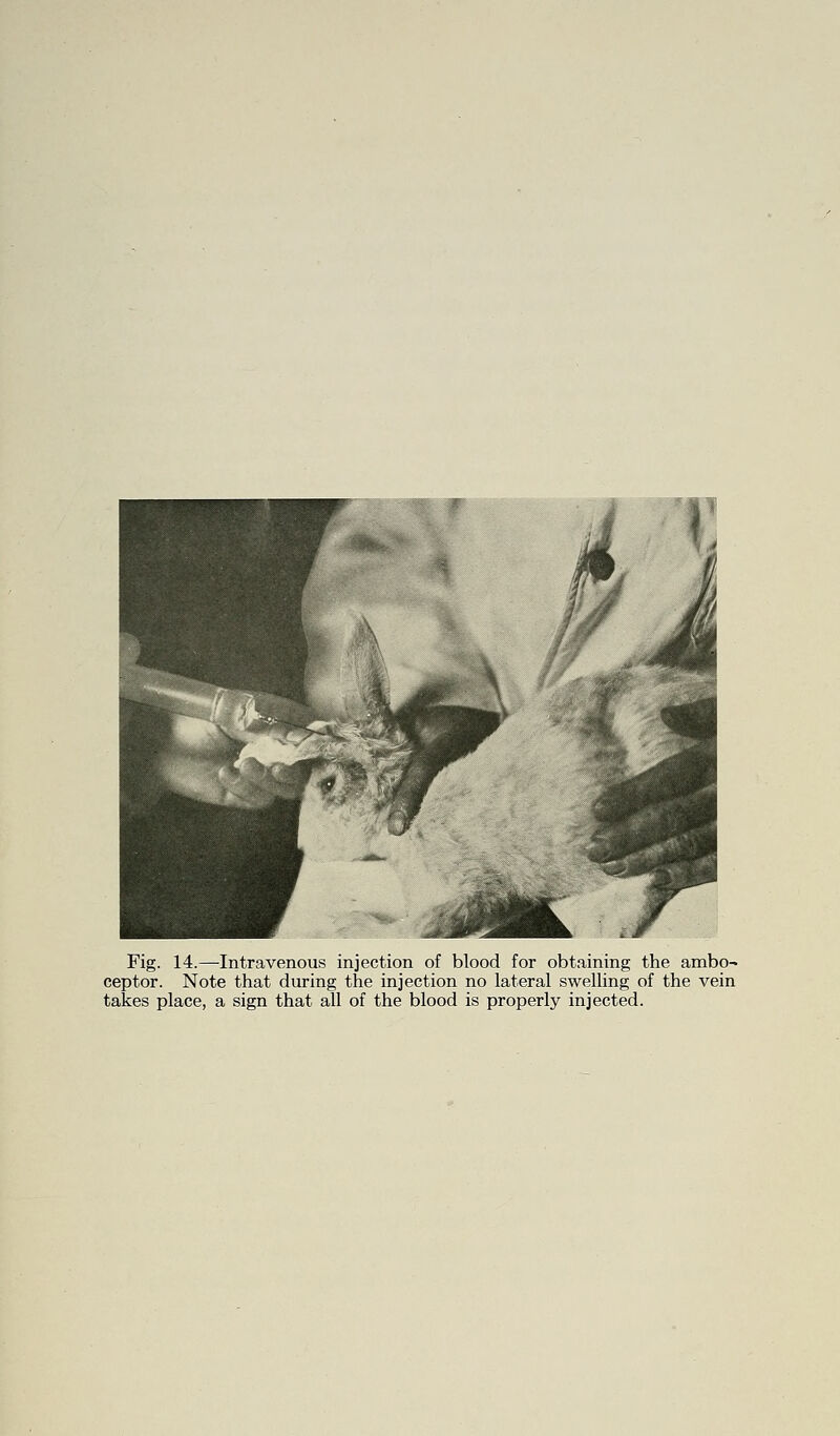 Fig. 14.—Intravenous injection of blood for obtaining the ambo- ceptor. Note that during the injection no lateral swelling of the vein takes place, a sign that all of the blood is properly injected.