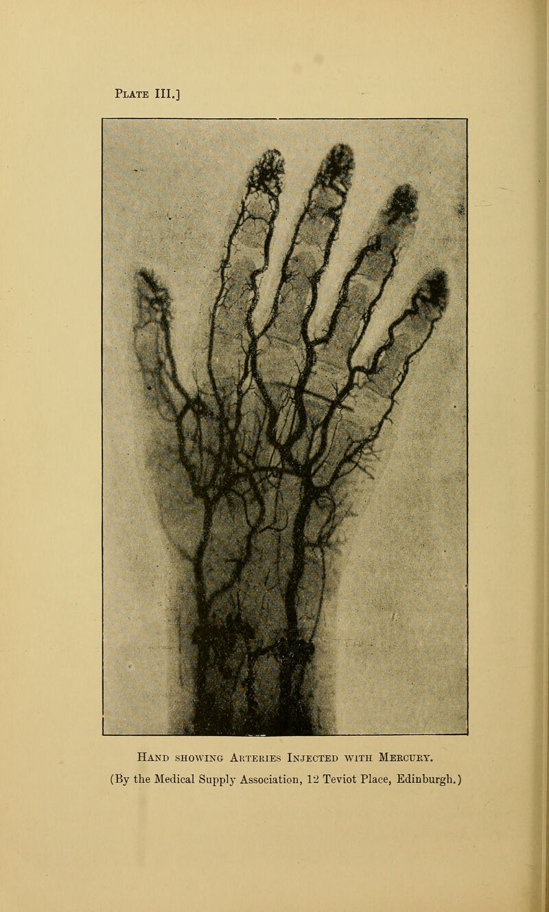 Plate III.] Hand showing Arteries Injected with Mercury.