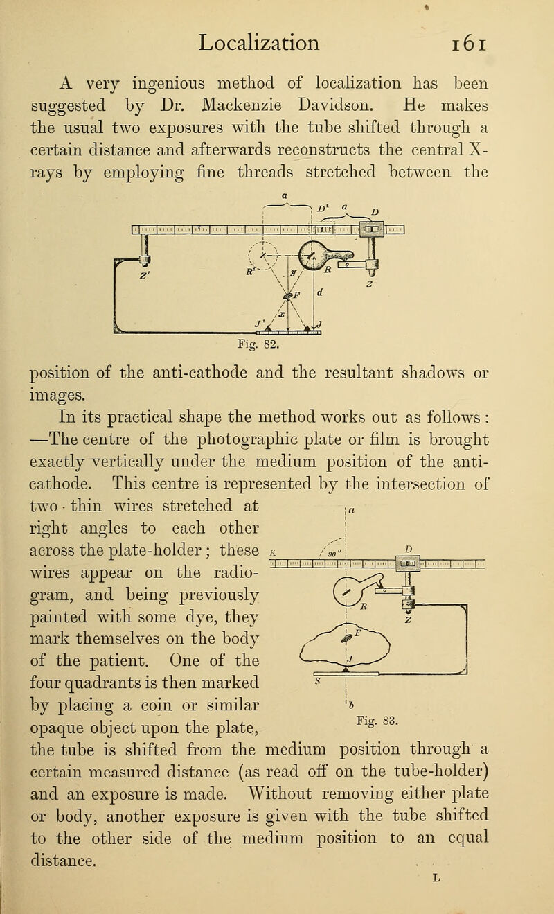 A very ingenious method of localization has been suggested by Dr. Mackenzie Davidson. He makes the usual two exposures with the tube shifted through a certain distance and afterwards reconstructs the central X- rays by employing fine threads stretched between the Fig. 82. position of the anti-cathode and the resultant shadows or images. In its practical shape the method works out as follows : —The centre of the photographic plate or film is brought exactly vertically under the medium position of the anti- cathode. This centre is represented by the intersection of two - thin wires stretched at ,„ right angles to each other across the plate-holder ; these wires appear on the radio- gram, and being previously painted with some dye, they mark themselves on the body of the patient. One of the four quadrants is then marked by placing a coin or similar opaque object upon the plate, the tube is shifted from the medium position through a certain measured distance (as read off on the tube-holder) and an exposure is made. Without removing either plate or body, another exposure is given with the tube shifted to the other side of the medium position to an equal distance. Fig. 83.