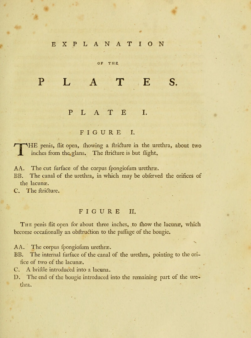 EXPLANATION OF THE T PLATES. PLATE I. FIGURE I. HE penis, flit open, fhowing a ftridure in the urethra, about two inches from the^glans. The ftridure is but flight. AA. The cut furface of the corpus fpongiofum urethra. BB. The canal of the urethra, in which may be obferved the orifices of the lacunae. C. The ilrifture. F I G U R E II. The penis flit open for about three inches, to fliow the lacunae, wliich become occafionally an obflrudion to the paflage of the bougie. A A. The corpus fpongiofum urethras. BB. The internal furface of the canal of the urethra,, pointing to the ori- fice of two of the lacuuce. C. A briftle introduced into a lacuna. D. The end of the bougie introduced into tlie remaining part of the ure- tlira.