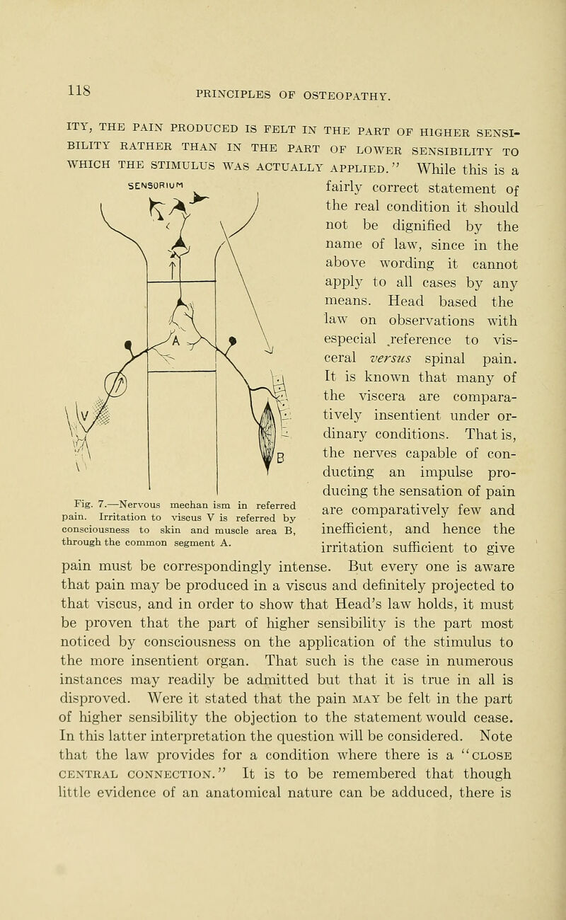 ITY, THE PAIN PRODUCED IS PELT IN THE PART OP HIGHER SENSI- BILITY RATHER THAN IN THE PART OF LOWER SENSIBILITY TO WHICH THE STIMULUS WAS ACTUALLY APPLIED. While this is a sENsoRiuM fairly correct statement of the real condition it should not be dignified by the name of law, since in the above wording it cannot apply to all cases by any means. Head based the law on observations with especial .reference to vis- ceral versus spinal pain. It is known that many of the viscera are compara- tively insentient under or- dinary conditions. That is, the nerves capable of con- ducting an impulse pro- ducing the sensation of pain are comparatively few and inefficient, and hence the irritation sufficient to give pain must be correspondingly intense. But every one is aware that pain may be produced in a viscus and definitely projected to that viscus, and in order to show that Head's law holds, it must be proven that the part of higher sensibility is the part most noticed by consciousness on the application of the stimulus to the more insentient organ. That such is the case in numerous instances may readily be admitted but that it is true in all is disproved. Were it stated that the pain may be felt in the part of higher sensibility the objection to the statement would cease. In this latter interpretation the question will be considered. Note that the law provides for a condition where there is a close CENTRAL CONNECTION. It is to be remembered that though little evidence of an anatomical nature can be adduced, there is Fig. 7.—Nervous mechan ism in referred pain. Irritation to viscus V is referred by- consciousness to skin and muscle area B, through the common segment A.