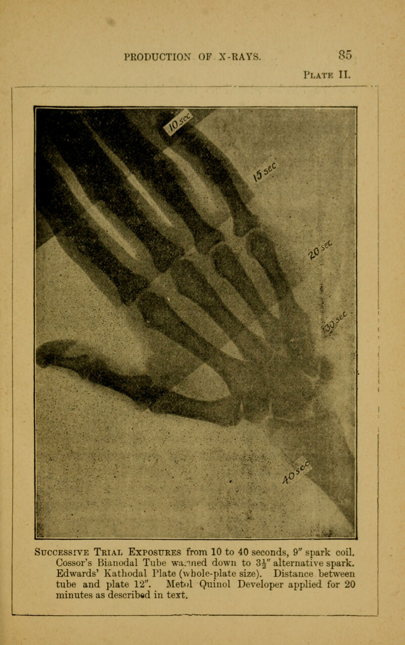 Pi.atk II. Successive Trial Exposures from 10 to 40 seconds, 9 spark coil. Cossor's Bianodal Tube wanned down to 3J alternative spark. Edwards' Kathodal Plate (avbole-plate size). Distance between tube and plate 12. Metul Quinol Developer applied for 20 minutes as described in text.