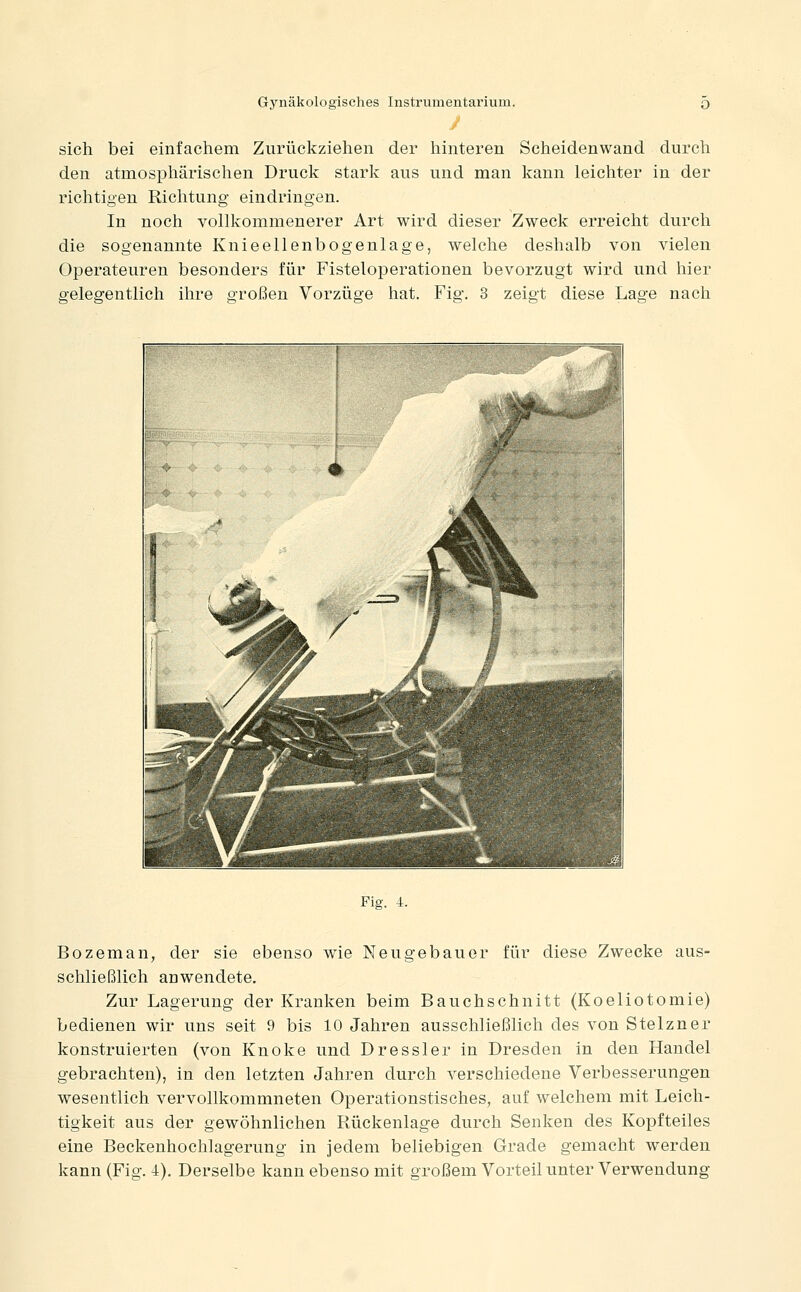 sich bei einfachem Zurückziehen der hinteren Scheidenwand durch den atmospliärischen Druck stark aus und man kann leichter in der richtigen Richtung eindringen. In noch vollkommenerer Art wird dieser Zweck erreicht durch die sogenannte Knieellenbogenlage, welche deshalb von vielen Operateuren besonders für Fisteloperationen bevorzugt wird und hier gelegentlich ihre großen Vorzüge hat. Fig. 3 zeigt diese Lage nach Fig. 4. Bozeman, der sie ebenso wie Neugebauer für diese Zwecke aus- schließlich anwendete. Zur Lagerung der Kranken beim Bauchschnitt (Koeliotomie) bedienen wir uns seit 9 bis 10 Jahren ausschließlich des von Stelzner konstruierten (von Knoke und Dressler in Dresden in den Handel gebrachten), in den letzten Jahren durch verschiedene Verbesserungen wesentlich vervollkommneten Operationstisches, auf welchem mit Leich- tigkeit aus der gewöhnlichen Rückenlage durch Senken des Kopfteiles eine Beckenhochlagerung in jedem beliebigen Grade gemacht werden kann (Fig. 4). Derselbe kann ebenso mit großem Vorteil unter Verwendung