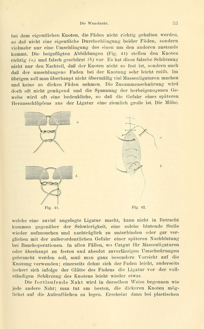 bei dem eigentlichen Knoten, die Fäden nicht richtig gehalten werden, so daJ3 nicht eine eigentliche Durchschlingung beider Fäden, sondern vielmehr nur eine Umschlingung des einen um den anderen zustande kommt. Die beigefügten Abbildungen (Fig. 41) stellen den Knoten richtig (a) und falsch geschürzt (bj vor. Es hat diese falsche Schürzung nicht nur den Nachteil, daß der Knoten nicht so fest ist, sondern auch daß der umschlungene Faden bei der Knotung sehr leicht reißt. Im übrigen soll man überhaupt nicht übermäßig viel Massenligaturen machen und keine zu dicken Fäden nehmen. Die Zusammenschnürung wird doch oft nicht genügend und die Spannung der herbeigezogenen Ge- webe wird oft eine bedenkliche, so daß die Gefahr eines späteren Herausschlüpfens aus der Ligatur eine ziemlich große ist. Die Mühe, Fig. 41. Fiar. 42. welche eine zuviel angelegte Ligatur macht, kann nicht in Betracht kommen gegenüber der Schwierigkeit, eine solche blutende Stelle wieder aufzusuchen und nachträglich zu unterbinden oder gar ver- glichen mit der außerordentlichen Gefahr einer späteren Nachblutung bei Bauchoperationen. In allen Fällen, wo Catgut für Massenligaturen oder überhaupt zu festen und absolut zuverlässigen Umschnürungen gebraucht werden soll, muß man ganz besondere Vorsicht auf die Knotung verwenden; einerseits dehnt sich der Faden leicht, anderseits lockert sich infolge der Glätte des Fadens die Ligatur vor der voll- ständigen Schürzung des Knotens leicht wieder etwas. Die fortlaufende Naht wird in derselben Weise begonnen wie jede andere Naht; man tut am besten, die dickeren Knoten mög- lichst auf die Außenflächen zu legen. Erscheint dann bei plastischen