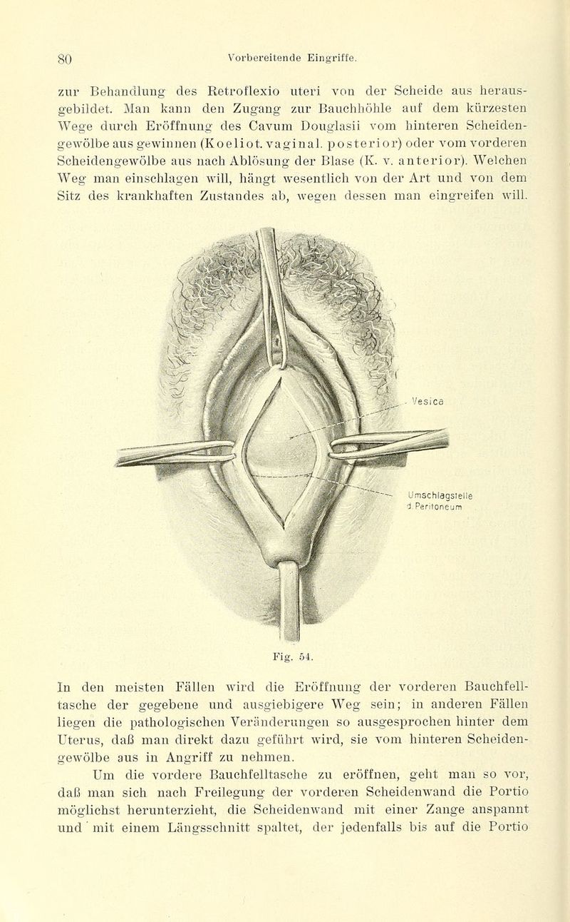 zur Behandlung des Retroflexio uteri von der Scheide aus heraus- gebildet. Man kann den Zugang zur Bauchhöhle auf dem kürzesten Wege durch Eröffnung des Cavum Douglasii vom hinteren Scheiden- gewölbe aus gewinnen (Koeliot. vaginal, posterior) oder vom vorderen Scheidengewölbe aus nach Ablösung der Blase (K. v. anterior). Welchen Weg man einschlagen will, hängt wesentlich von der Art und von dem Sitz des krankhaften Zustandes ab, wegen dessen man eingreifen will. Umschlagstelle ci, Peritoneum Fig. 54. In den meisten Fällen wird die Eröffnung der vorderen Bauchfell- tasche der gegebene und ausgiebigere Weg sein; in anderen Fällen liegen die pathologischen Veränderungen so ausgesprochen hinter dem Uterus, daß man direkt dazu geführt wird, sie vom hinteren Scheiden- gewölbe aus in Angriff zu nehmen. Um die vordere Bauchfelltasche zu eröffnen, geht man so vor, daß man sich nach Freilegung der vorderen Scheidenwand die Portio möglichst herunterzieht, die Scheidenwand mit einer Zange anspannt und mit einem Längsschnitt spaltet, der jedenfalls bis auf die Portio