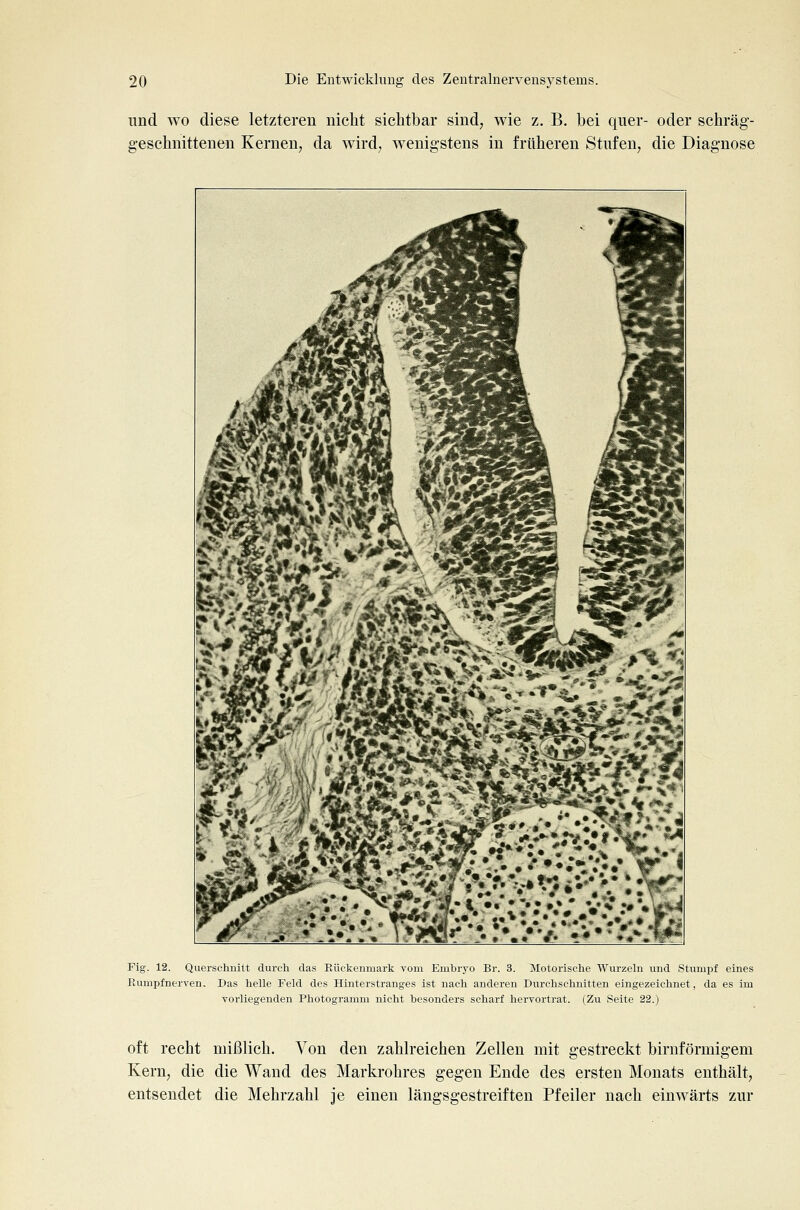 lind wo diese letzteren niclit sichtbar sind, wie z. B. bei quer- oder schräg- geschnittenen Kernen, da wird, wenigstens in früheren Stufen, die Diagnose Fig. 12. Querschnitt durch das Eückenmark vom Embryo Br. 3. Motorische Wurzehi und Stumpf eines Eumpfnerven, Das lielle Feld des Hinterstranges ist nach anderen Durchschnitten eingezeichnet, da es im vorliegenden Photogramm nicht besonders scharf hervortrat. (Zu Seite 22.) oft recht mißlich. Von den zahlreichen Zellen mit gestreckt birnförmigem Kern, die die Wand des Markrohres gegen Ende des ersten Monats enthält, entsendet die Mehrzahl je einen längsgestreiften Pfeiler nach einwärts zur