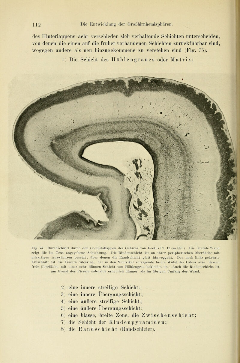 des Hinterlappeiis acht verschieden sich verhaltende Schichten unterscheiden, von denen die einen auf die früher vorhandenen Schichten zurückführbar sind, wogegen andere als neu hinzugekommene zu verstehen sind (Fig. 75). I) Die Schicht des Höhlengraues oder Matrix; Fig. 75. Durchsehuitt durch den Occipitallappen des Gehirns von Foetu.s PI (12 cm SSL). Die laterale Wand zeigt die im Text angegebene Schichtung. Die Eindenschicht ist an ihrer peripherischen Oberfläche mit pilzartigen Auswüclisen besetzt, über denen die Eandschicht glatt hinweggeht. Der nach links gekehrte Einschnitt ist die Fissura calcarina, der in den Ventrikel vorragende breite Wulst der Calcar avis, dessen freie Oberfläche mit einer sehr dünnen Schicht von Höhlengrau bekleidet ist. Auch die Eindenschicht ist am Grund der Fissura calcarina erheblich dünner, als im übrigen Umfang der Wand. 2) eine innere streifige Schicht; 3) eine innere Übergangsschicht; 4) eine äußere streifige Schicht; 5) eine äußere Übergangsschicht; 6) eine blasse, breite Zone, die Zwischenschicht; 7j die Schicht der Rindenpyramiden; 8) die Eandschicht (Randschleier).