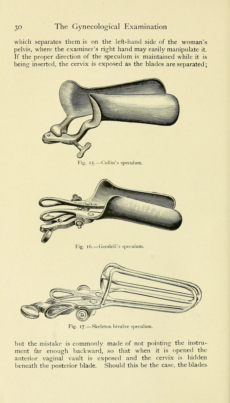 which separates them is on the left-hand side of the woman's pelvis, where the examiner's right hand may easily manipulate it. If the proper direction of the speculum is maintained while it is being inserted, the cervix is exposed as the blades are separated; Fig. 15.—Collin's speculum. Fig. 16.—Goodell's speculum. Fig. 17.—Skeleton bivalve speculum. but the mistake is commonly made of not pointing the instru- ment far enough backward, so that when it is opened the anterior vaginal vault is exposed and the cervix is hidden beneath the posterior blade. Should this be the case, the blades.