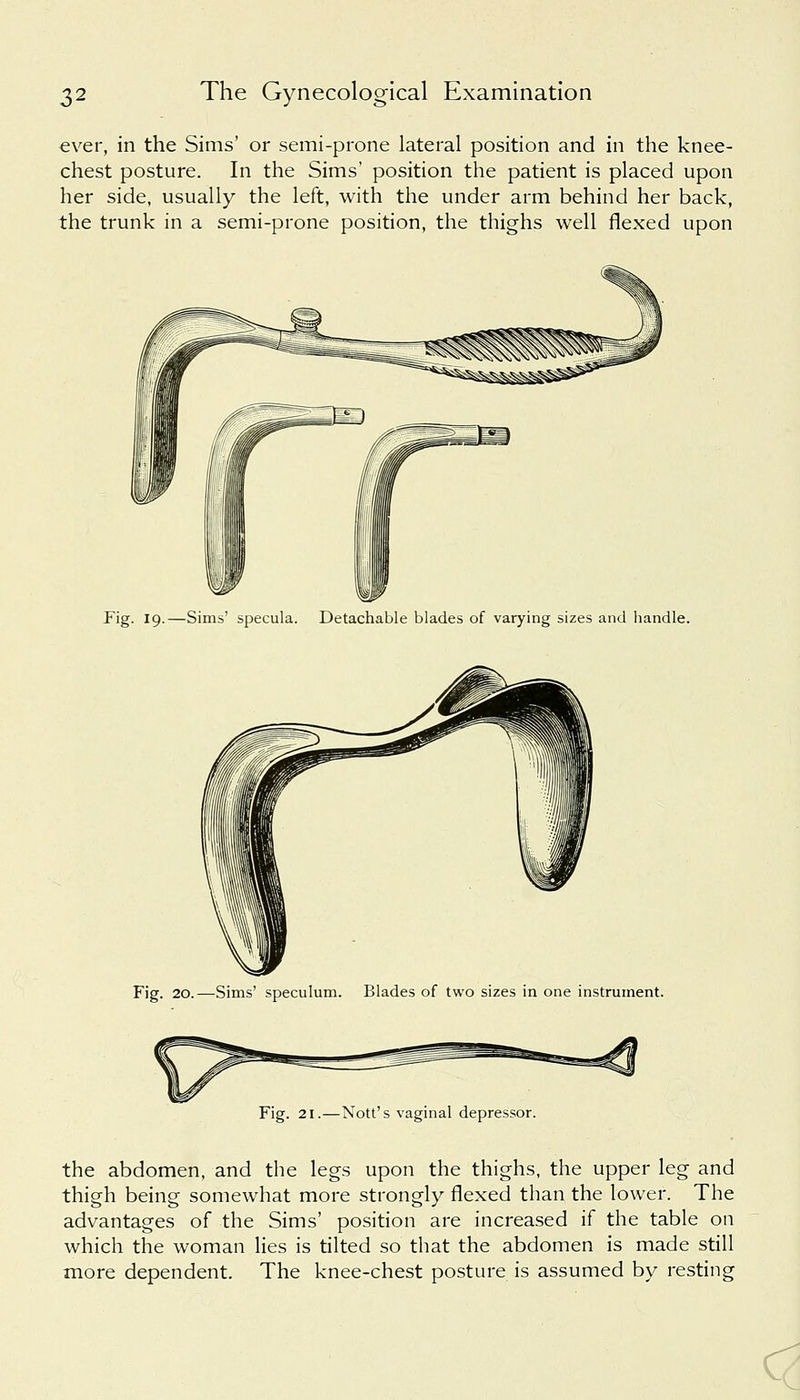 ever, in the Sims' or semi-prone lateral position and in the knee- chest posture. In the Sims' position the patient is placed upon her side, usually the left, with the under arm behind her back, the trunk in a semi-prone position, the thighs well flexed upon Fig. 19.—Sims' specula. Detachable blades of varying sizes and handle. Fig. 20.—Sims' speculum. Blades of two sizes in one instrument. Fig. 21.—Nott's vaginal depressor. the abdomen, and the legs upon the thighs, the upper leg and thigh being somewhat more strongly flexed than the lower. The advantages of the Sims' position are increased if the table on which the woman lies is tilted so that the abdomen is made still more dependent. The knee-chest posture is assumed by resting
