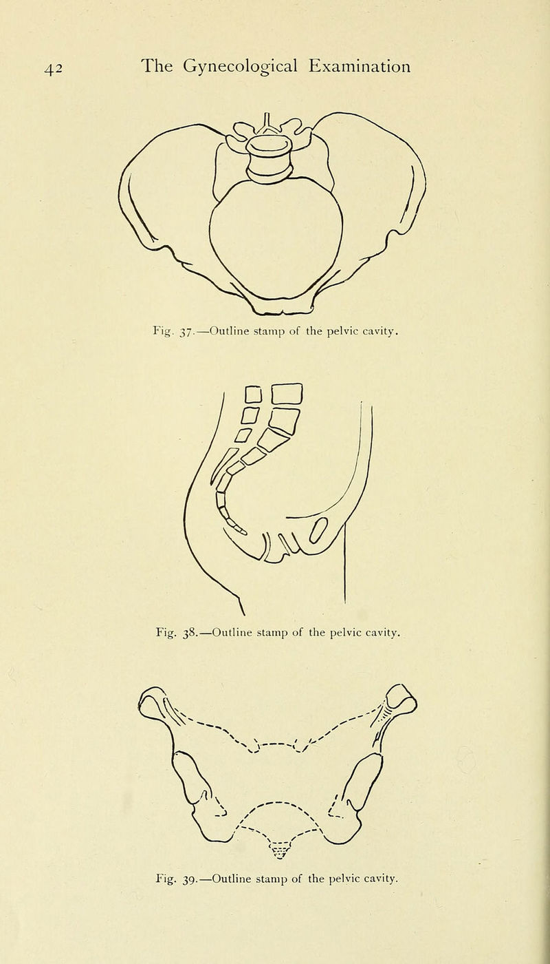 Fig- 37-—Outline stamp of the pelvic cavity. Fig. 38.—Outline stamp of the pelvic cavity. Fig- 39-—Outline stamp of the pelvic cavity.
