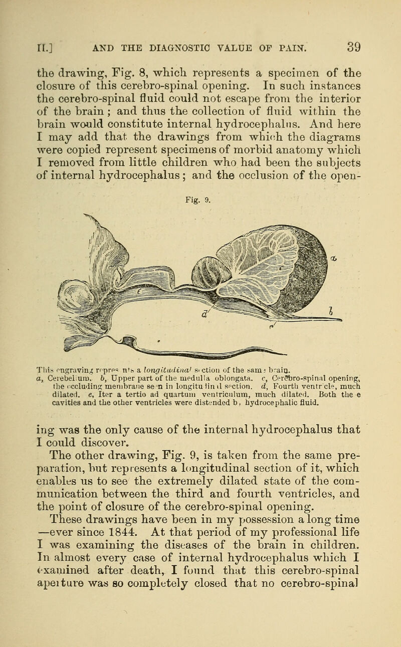 the drawing, Fig. 8, which represents a specimen of the closure of this cerebro-spinal opening. In such instances the cerebro-spinal fluid could not escape from the interior of the brain; and thus the collection of fluid within the brain would constitute internal hydrocephalus. And here I may add that the drawings from whi(!h the diagrams were copied represent specimens of morbid anatomy which I removed from little children who had been the subjects of internal hydrocephalus ; and the occlusion of the open- Fig. 9. This ongravin,^ r^prp* nth a longitadina' sictiou of the sanii braia. a, CerebelurD. b, Upper part of the medulla oblongata, c, Cpr?bro-spinal opening, the occluding membrane se 'n in longitu Mri il section, d, Fourth ventr cle, much dilated, e. Iter a tertio ad quartum ventricnlum, much dilated. Both the e cavities and the other ventricles were distended b, hydrocephalic fluid. ing was the only cause of the internal hydrocephalus that I could discover. The other drawing, Fig. 9, is taken from the same pre- paration, but represents a longitudinal section of it, which enables us to see the extremely dilated state of the com- munication between the third and fourth ventricles, and the point of closure of the cerebro-spinal opening. These drawings have been in my possession a long time —ever since 1844. At that period of my professional life I was examining the diseases of the brain in children. In almost every case of internal hydrocephalus which I examined after death, I found that this cerebro-spinal apeiture was so completely closed that no cerebro-spinal