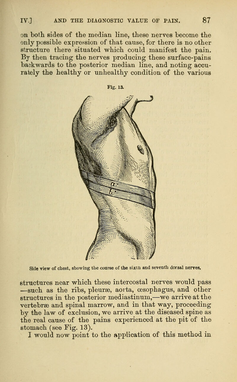 on both sides of the median line, these nerves become the only possible expression of that canse, for there is no other structure there situated which could manifest the pain. By then tracing the nerves producing these surface-pains backwards to the posterior median line, and noting accu- rately the healthy or unhealthy condition of the various Fig. 13. Side view of chest, showing the course of the sixtn and seventh dorsal nerves. structures near which these intercostal nerves would pass —such as the ribs, pleurae, aorta, oesophagus, and other structures in the posterior mediastinum,—we arrive at the vertebrae and spinal marrow, and in that way, proceeding by the law of exclusion, we arrive at the diseased spine as the real cause of the pains experienced at the pit of the stomach (see Fig. 13). I would now point to the application of this method in