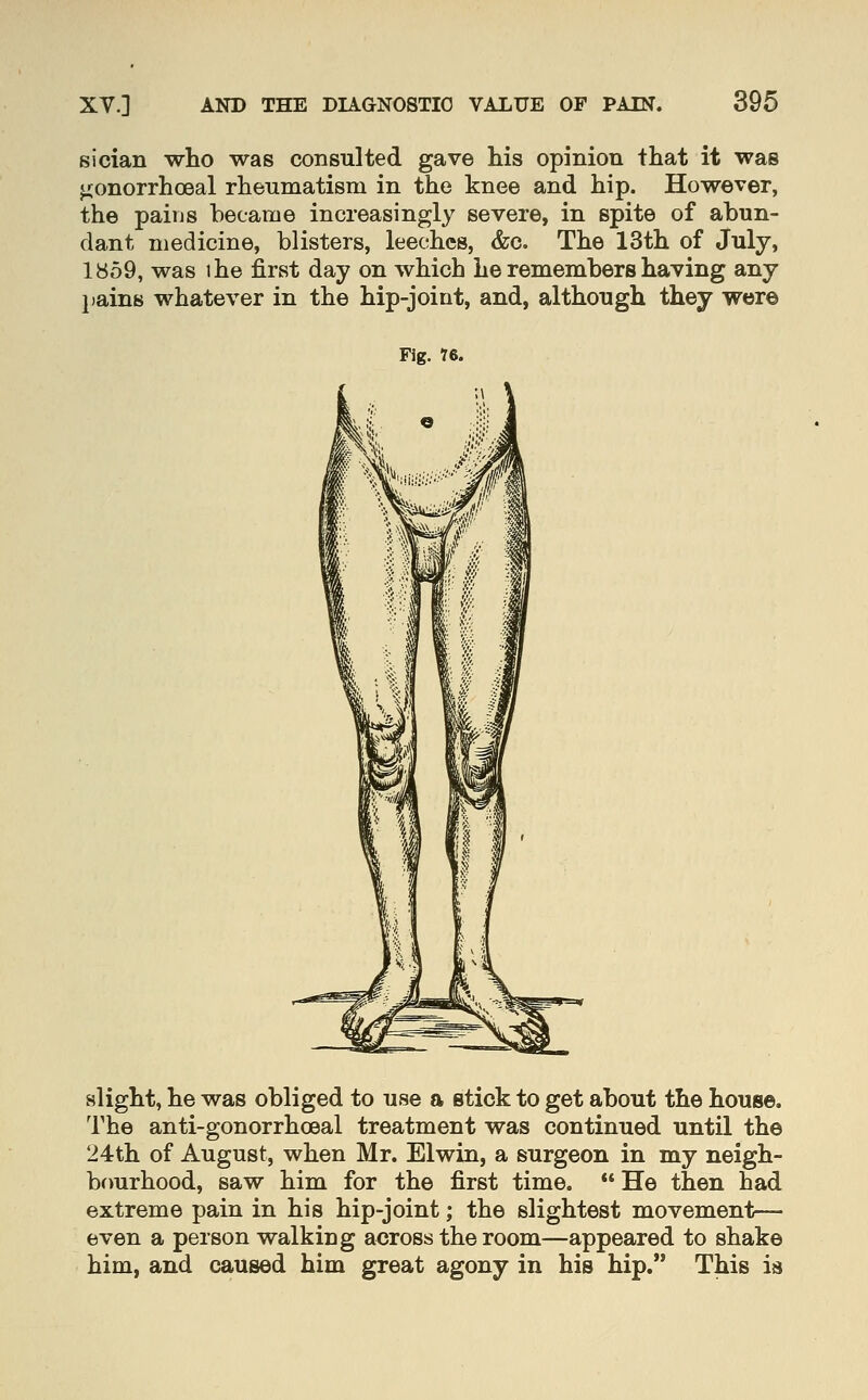 sician who was consulted gave his opinion that it was jionorrhoeal rheumatism in the knee and hip. However, the paiiis became increasingly severe, in spite of abun- dant medicine, blisters, leeches, &c. The 13th of July, 1859, was the first day on which he remembers having any jjains whatever in the hip-joint, and, although they were Fig. 76. slight, he was obliged to use a stick to get about the house. The anti-gonorrhoeal treatment was continued until the 24th of August, when Mr. Elwin, a surgeon in my neigh- brmrhood, saw him for the first time.  He then had extreme pain in his hip-joint; the slightest movement— even a person walking across the room—appeared to shake him, and caused him great agony in his hip. This is