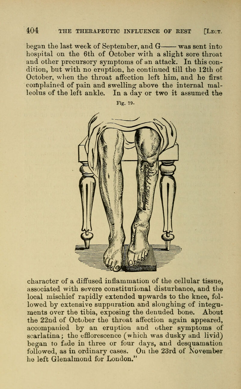 began the last week of September, and G was sent into hospital on the 6th of October with a slight sore throat and other precursory symptoms of an attack. In this con- dition, but with no eruption, he continued till the 12th of October, wlien the throat affection left him, and he first complained of pain and swelling above the internal mal- leolus of the left ankle. In a day or two it assumed the Fig. 79. character of a diffused inflammation of the cellular tissue, associated with severe constitutional disturbance, and the local mischief rapidly extended upwards to the knee, fol- lowed by extensive suppuration and sloughing of integu- ments over the tibia, exposing the denuded bone. About the 22nd of October the throat affection again appeared, accompanied by an eruptiou and other symptoms of scarlatina; the efflorescence (which was dusky and livid) began to fade in three or four days, and desquamation followed, as in ordinary cases. Oii the 23rd of JS'ovember ho left Glenalmond for London,*'