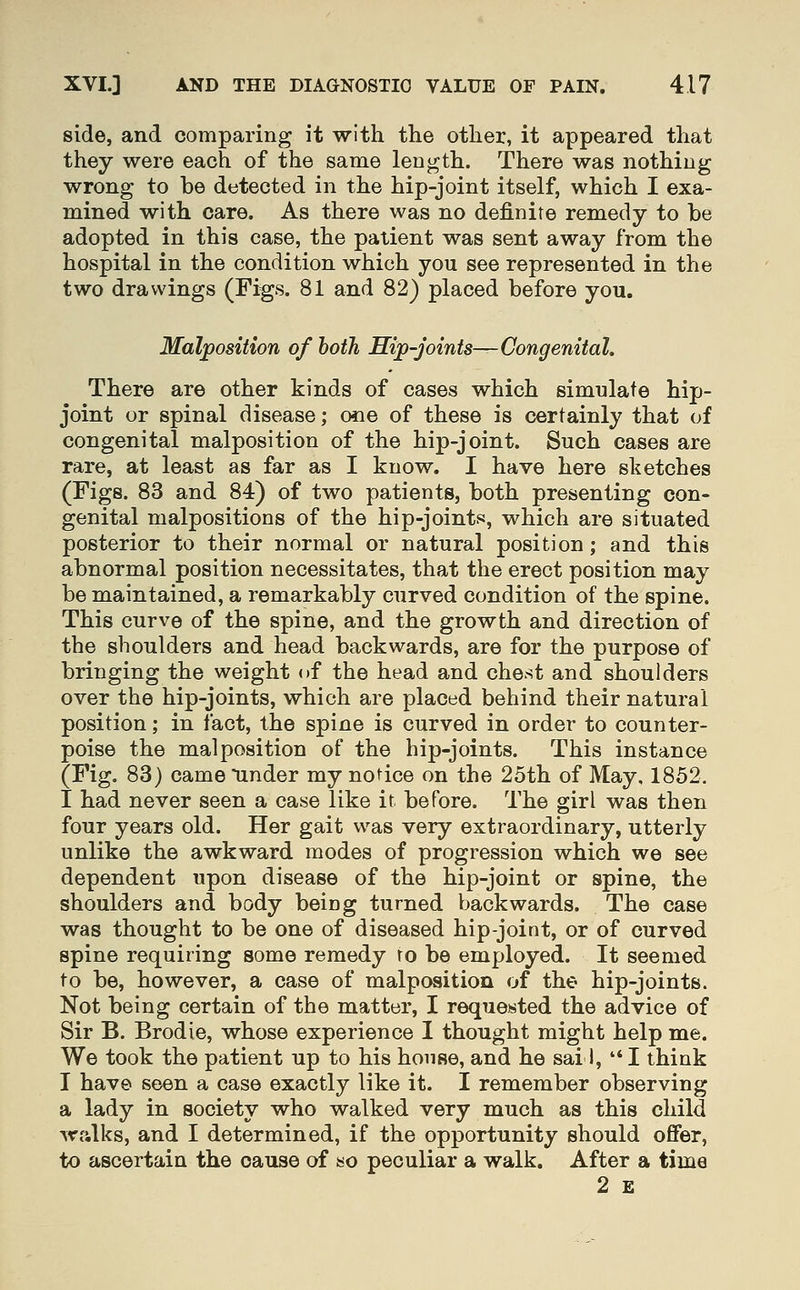 side, and comparing it with the other, it appeared that they were each of the same length. There was nothing wrong to be detected in the hip-joint itself, which I exa- mined with care. As there was no definite remedy to be adopted in this case, the patient was sent away from the hospital in the condition which you see represented in the two drawings (Figs, 81 and 82) placed before yon. Malposition of both Hip-joints—Congenital. There are other kinds of cases which simulate hip- joint or spinal disease; one of these is certainly that of congenital malposition of the hip-joint. Such cases are rare, at least as far as I know. I have here sketches (Figs. 83 and 84) of two patients, both presenting con- genital malpositions of the hip-joints, which are situated posterior to their normal or natural position; and this abnormal position necessitates, that the erect position may be maintained, a remarkably curved condition of the spine. This curve of the spine, and the growth and direction of the shoulders and head backwards, are for the purpose of bringing the weight of the head and chest and shoulders over the hip-joints, which are placed behind their natural position; in fact, the spine is curved in order to counter- poise the malposition of the hip-joints. This instance (Fig. 83) came under my notice on the 25th of May, 1852. I had never seen a case like it before. The girl was then four years old. Her gait was very extraordinary, utterly unlike the awkward modes of progression which we see dependent upon disease of the hip-joint or spine, the shoulders and body being turned backwards. The case was thought to be one of diseased hip-joint, or of curved spine requiring some remedy ro be employed. It seemed to be, however, a case of malposition of the hip-joints. Not being certain of the matter, I requested the advice of Sir B. Brodie, whose experience I thought might help me. We took the patient up to his house, and he sai I, '*I think I have seen a case exactly like it. I remember observing a lady in society who walked very much as this child walks, and I determined, if the opportunity should offer, to ascertain the cause of so peculiar a walk. After a time 2 £
