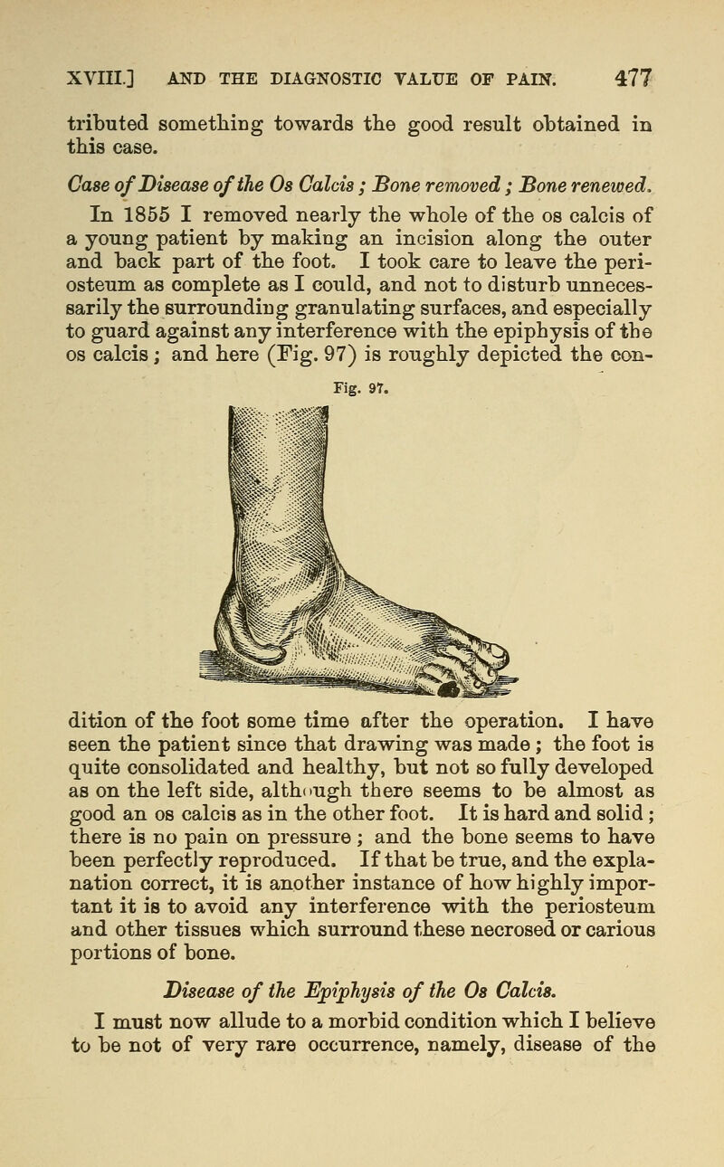 tributed sometliing towards the good result obtained in this case. Case of Disease of the Os Galcis ; Bone removed; Bone renewed. In 1855 I removed nearly the whole of the os calcis of a young patient by making an incision along the outer and back part of the foot. I took care to leave the peri- osteum as complete as I could, and not to disturb unneces- sarily the surrounding granulating surfaces, and especially to guard against any interference with the epiphysis of the OS calcis; and here (Fig. 97) is roughly depicted the con- Fig. 97. dition of the foot some time after the operation. I have seen the patient since that drawing was made; the foot is quite consolidated and healthy, but not so fully developed as on the left side, although there seems to be almost as good an os calcis as in the other foot. It is hard and solid; there is no pain on pressure ; and the bone seems to have been perfectly reproduced. If that be true, and the expla- nation correct, it is another instance of how highly impor- tant it is to avoid any interference with the periosteum and other tissues which surround these necrosed or carious portions of bone. Disease of the Epiphysis of the Os Calcis. I must now allude to a morbid condition which I believe to be not of very rare occurrence, namely, disease of the