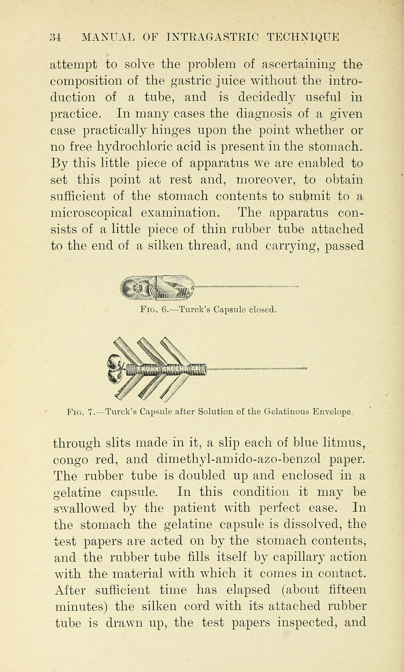 attempt to solve the problem of ascertaining the composition of the gastric juice without the intro- duction of a tube, and is decidedly useful in practice. In many cases the diagnosis of a given case practically hinges upon the point whether or no free hydrochloric acid is present in the stomach. By this little piece of apparatus we are enabled to set this point at rest and, moreover, to obtain sufficient of the stomach contents to submit to a microscopical examination. The apparatus con- sists of a little piece of thin rubber tube attached to the end of a silken thread, and carrying, passed Turck's Capsule closed. Fig. 7.—Turck's Capsule after Solution of the Gelatinous Envelope. through slits made in it, a slip each of blue litmus, congo red, and dimethyl-amido-azo-benzol paper. The rubber tube is doubled up and enclosed in a gelatine capsule. In this condition it may be swallowed by the patient with perfect ease. In the stomach the gelatine capsule is dissolved, the test papers are acted on by the stomach contents, and the rubber tube fills itself by capillary action with the material with which it comes in contact. After sufficient time has elapsed (about fifteen minutes) the silken cord with its attached rubber tube is drawn up, the test papers inspected, and