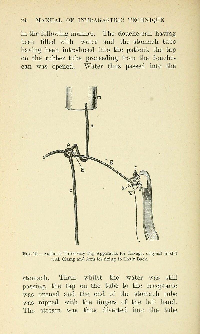 in the following manner. The douche-can having been filled with water and the stomach tube having been introduced into the patient, the tap on the rubber tube proceeding from the douche- can was opened. Water thus passed into the Fig. 18.—Author's Three-way Tap Apparatus for Lavage, original model with Clamp and Arm for fixing to Chair Back. stomach. Then, whilst the water was still passing, the tap on the tube to the receptacle was opened and the end of the stomach tube was nipped with the fingers of the left hand. The stream was thus diverted into the tube