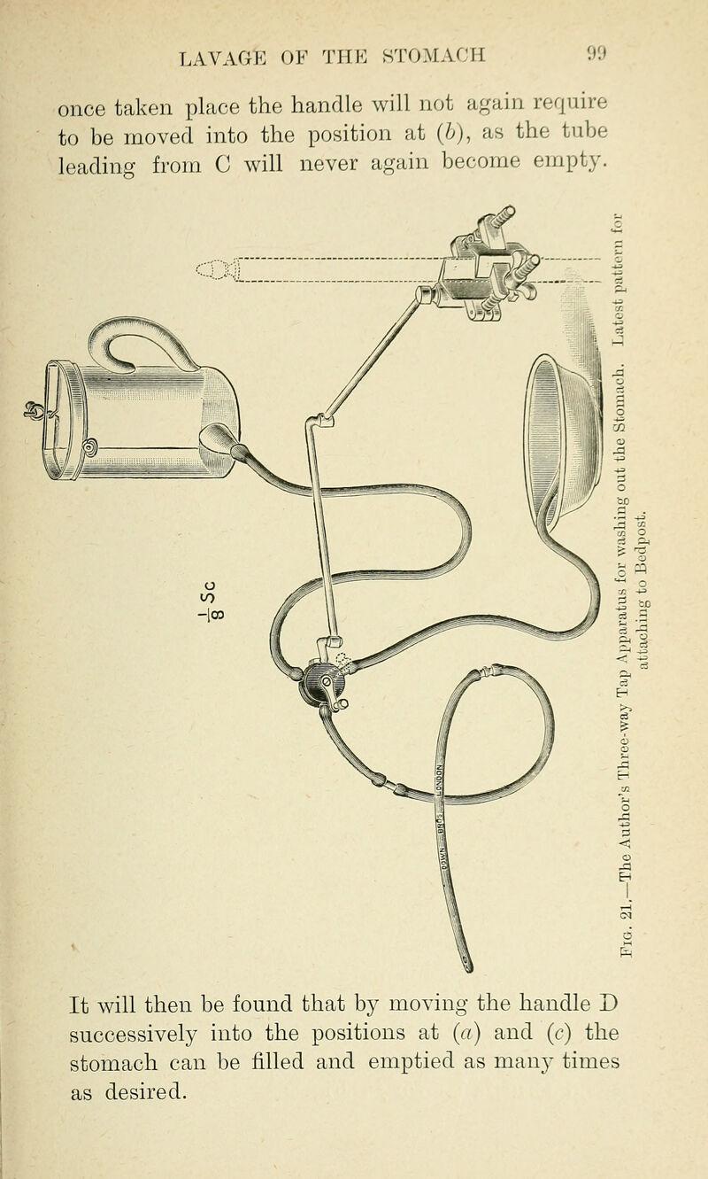 once taken place the handle will not again require to be moved into the position at (&), as the tube leading from C will never again become empty. It will then be found that by moving the handle D successively into the positions at (a) and (c) the stomach can be filled and emptied as many times as desired.