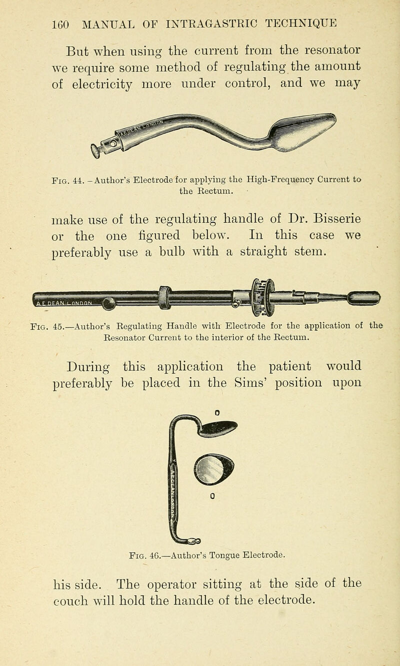 But when using the current from the resonator we require some method of regulating the amount of electricity more under control, and we may Fig. 44. -Author's Electrode for applying the High-Frequency Current to the Rectum. make use of the regulating handle of Dr. Bisserie or the one figured below. In this case we preferably use a bulb with a straight stem. ■piQ, 45.—Author's Regulating Handle with Electrode for the application of the Resonator Current to the interior of the Rectum. During this application the patient would preferably be placed in the Sims' position upon Fig. 46.—Author's Tongue Electrode. his side. The operator sitting at the side of the couch will hold the handle of the electrode.