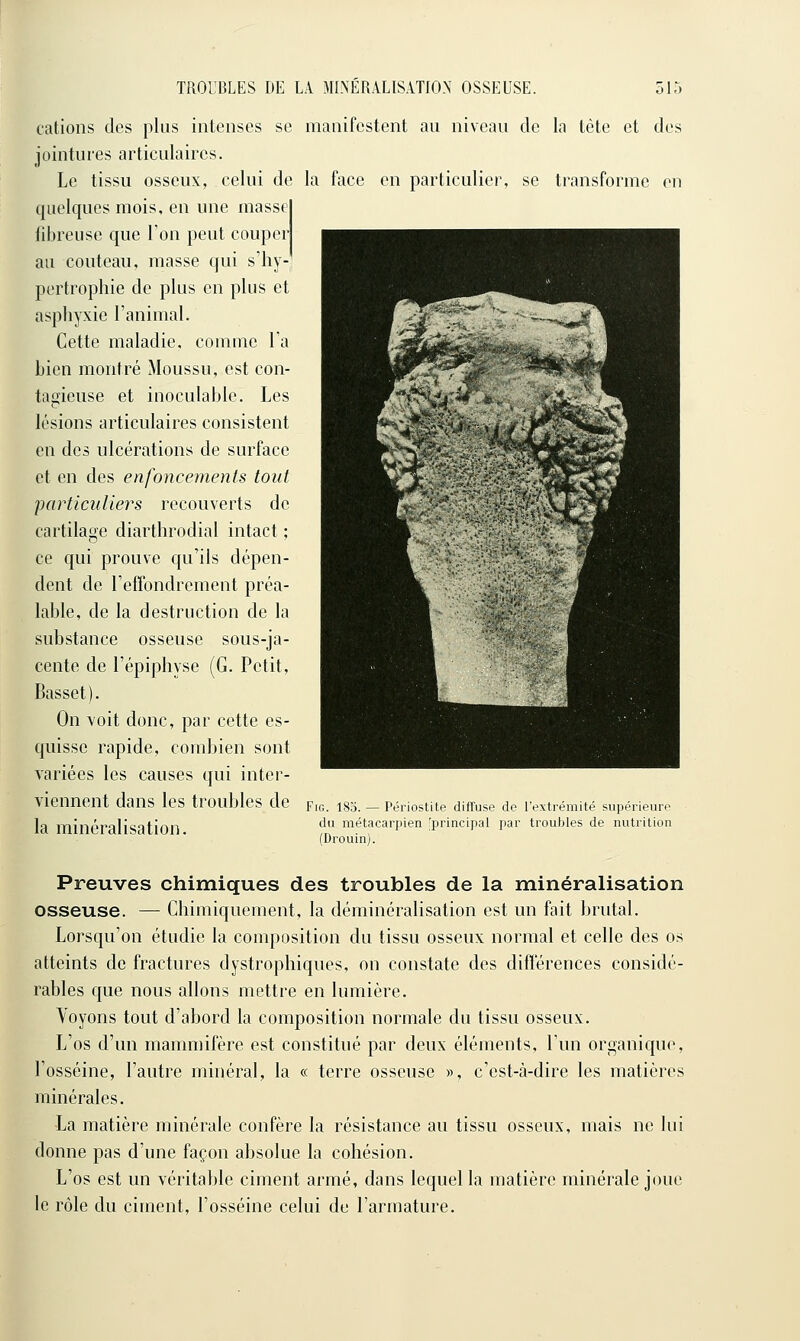 talions des plus intenses se manifestent au niveau de la tète et dos jointures articulaires. Le tissu osseux, celui de la face en particulier, se transforme on quelques mois, en une masse fibreuse que Ton peut couper au couteau, masse qui s'iiy- pertrophie de plus en plus et asphyxie l'animal. Cette maladie, comme Ta bien montré Moussu, est con- tagieuse et inoculable. Les lésions articulaires consistent on des ulcérations de surface et en des enfoncements tout •particuliers recouverts de cartilage diarthrodial intact ; ce qui prouve qu'ils dépen- dent de l'effondrement préa- lable, de la destruction de la substance osseuse sous-ja- cente de l'épiphyse (G. Petit, Basset). On voit donc, par cette es- quisse rapide, combien sont variées les causes qui inter- viennent dans les troubles de Feg. ISS. — Pérlostite diffuse de l'extrémité supérieure la minéralisation ^^^ métacarpien 'principal par troubles de nutrition (Drouin). Preuves chimiques des troubles de la minéralisation osseuse. — Chimiquement, la déminéralisation est un fait brutal. Lorsqu'on étudie la composition du tissu osseux normal et celle des os atteints de fractures dystrophiques, on constate des différences considé- rables que nous allons mettre en lumière. Voyons tout d'abord la composition normale du tissu osseux. L'os d'un mammifère est constitué par deux éléments, l'un organique, l'osséine, l'autre minéral, la « terre osseuse », c'est-à-dire les matières minérales. La matière minérale confère la résistance au tissu osseux, mais ne lui donne pas d'une façon absolue la cohésion. L'os est un véritable ciment armé, dans lequel la matière minérale joue le rôle du ciment, l'osséine celui de l'armature.