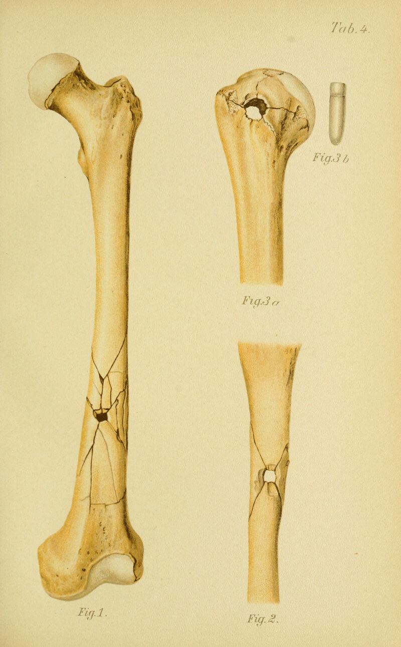 \ I , f-A W Fig.3h Fxq.3{ Fiß.l. Fig. 2.