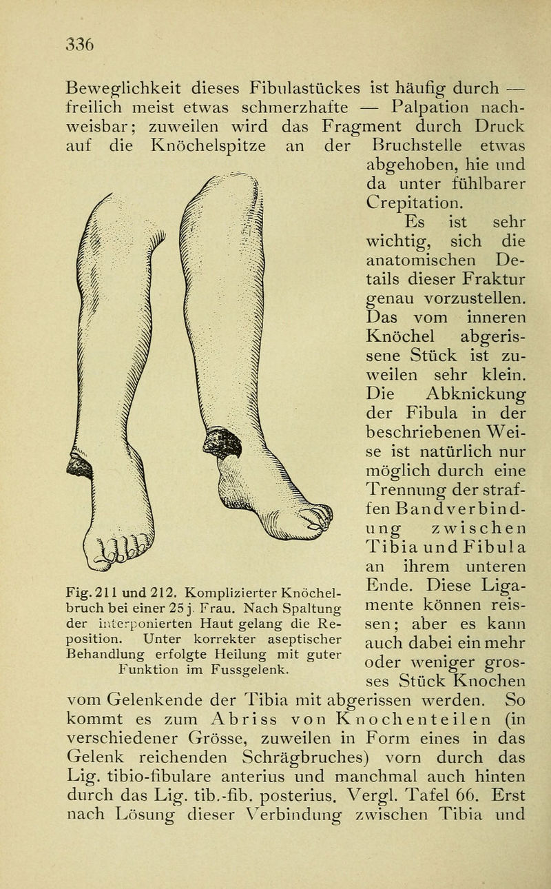 auf die Knöchelspitze Beweglichkeit dieses Fibulastückes ist häufig durch — freilich meist etwas schmerzhafte — Palpation nach- weisbar; zuweilen wird das Fragment durch Druck an der Bruchstelle etwas abgehoben, hie und da unter fühlbarer Crepitation. Es ist sehr wichtig, sich die anatomischen De- tails dieser Fraktur genau vorzustellen. Das vom inneren Knöchel abgeris- sene Stück ist zu- weilen sehr klein. Die Abknickung der Fibula in der beschriebenen Wei- se ist natürlich nur möglich durch eine Trennung der straf- fen Bandverbind- ung zwischen Tibia und Fibula an ihrem unteren Ende. Diese Liga- mente können reis- sen; aber es kann auch dabei ein mehr oder weniger gros- ses Stück Knochen vom Gelenkende der Tibia mit abgerissen werden. So kommt es zum Abriss von Knochen teilen (in verschiedener Grösse, zuweilen in Form eines in das Gelenk reichenden Schrägbruches) vorn durch das Lig. tibio-fibulare anterius und manchmal auch hinten durch das Lig. tib.-fib. posterius. Vergl. Tafel 66. Erst nach Lösung dieser Verbindung zwischen Tibia und Fig. 211 und 212. Komplizierter Knöchel- bruch bei einer 25 j. Frau. Nach Spaltung der interponierten Haut gelang die Re- position. Unter korrekter aseptischer Behandlung erfolgte Heilung mit guter Funktion im Fussgelenk.