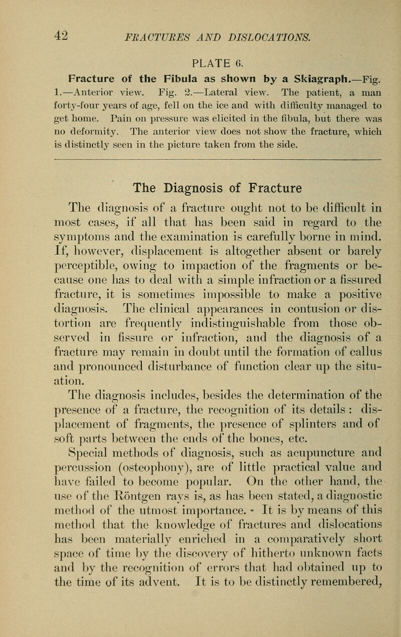 PLATE 6. Fracture of the Fibula as shown by a Skiagraph.—Fig. 1.—Anterior vieAv. Fig. 2.—Lateral view. The patient, a man forty-four years of age, fell on the ice and with difl&culty managed to get home. Pain on pressure was elicited in the fibula, but there was no deformity. The anterior view does not show the fracture, which is distinctly seen in the picture taken from the side. The Diagnosis of Fracture The diagnosis of a fracture ought not to be difficult in most caseSj if all that has been said in regard to the symptoms and the examination is carefully borne in mind. If, however, displacement is altogether absent or barely perceptible, owing to impaction of the fragments or be- cause one has to deal with a simple infraction or a fissured fracture, it is sometimes impossible to make a positive diagnosis. The clinical appearances in contusion or dis- tortion are frequently indistinguishable from those ob- served in fissure or infraction, and the diagnosis of a fracture may remain in doubt until the formation of callus and pronounced disturbance of function clear up the situ- ation. The diagnosis includes, besides the determination of the presence of a fracture, the recognition of its details : dis- placement of fragments, the presence of splinters and of soft parts between the ends of the bones, etc. Special methods of diagnosis, such as acupuncture and percussion (osteophony), are of little practical value and have failed to become popular. On the other hand, the use of the Kontgen rays is, as has been stated, a diagnostic method of the utmost importance. - It is by means of this method that the knowledge of fractures and dislocations has been materially enriched in a comparatively short space of time by the discovery of hitherto unknown facts and by the recognition of errors that liad obtained up to the time of its advent. It is to be distinctly remembered,