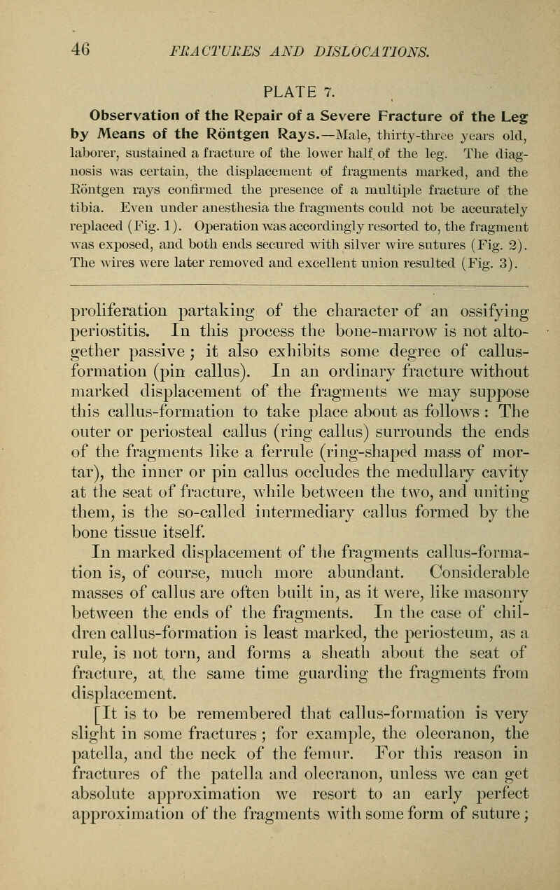 PLATE 7. , Observation of the Repair of a Severe Fracture of the Leg by Means of the Rontgen Rays.—Male, thirty-three years old, laborer, sustained a fracture of the lower half, of the leg. The diag- nosis was certain, the displacement of fragments marked, and the R5ntgen rays confirmed the presence of a multiple fracture of the tibia. Even under anesthesia the fragments could not be accurately replaced (Fig. 1). Operation was accordingly resorted to, the fragment was exposed, and both ends secured with silver wire sutures (Fig. 2). The wires were later removed and excellent union resulted (Fig. 3). proliferation partaking of the character of an ossifying periostitis. In this process the bone-marrow is not alto- gether passive ; it also exhibits some degree of callus- formation (pin callus). In an ordinary fracture Avithout marked displacement of the fragments Ave may suppose this callus-formation to take place about as foUoAvs : The outer or periosteal callus (ring callus) surrounds the ends of the fragments like a ferrule (riug-shaped mass of mor- tar), the inner or pin callus occludes the medullary cavity at the seat of fracture, Avhile betw^een the two, and uniting them, is the so-called intermediary callus formed by the bone tissue itself. In marked displacement of tlie fragments callus-forma- tion is, of course, much more abundant. Considerable masses of callus are often built in, as it were, like masonry between the ends of the fragments. In the case of chil- dren callus-formation is least marked, the periosteum, as a rule, is not torn, and forms a sheath about the seat of fracture, at the same time guarding the fragments from displacement. [It is to be remembered that callus-formation is very slight in some fractures ; for example, the oleoranon, the patella, and the neck of the femur. For this reason in fractures of the patella and olecranon, unless Ave can get absolute approximation we resort to an early perfect approximation of the fragments with some form of suture;