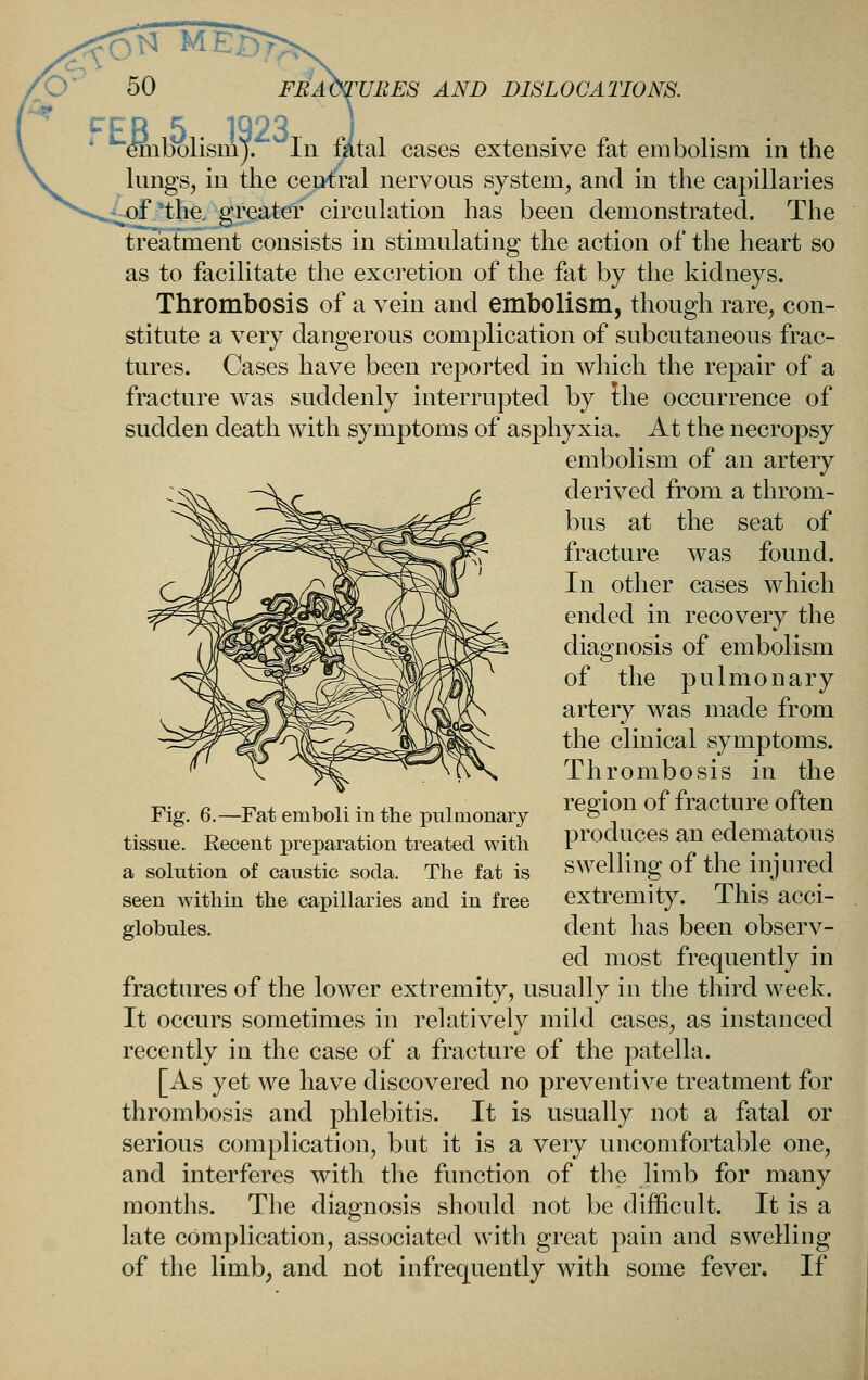 ' embolismj. In fatal cases extensive fat embolism in the lungs, in the central nervous system, and in the capillaries -of the. greater circulation has been demonstrated. The treiatment consists in stimulating the action of the heart so as to facilitate the excretion of the fat by the kidneys. Thrombosis of a vein and embolism, though rare, con- stitute a very dangerous complication of subcutaneous frac- tures. Cases have been reported in which the repair of a fracture was suddenly interrupted by Ihe occurrence of sudden death with symptoms of asphyxia. At the necropsy embolism of an artery derived from a throm- bus at the seat of fracture was found. In other cases which ended in recovery the diagnosis of embolism of the pulmonary artery was made from the clinical symptoms. Thrombosis in the region of fracture often produces an edematous swelling of the injured extremity. This acci- dent has been observ- ed most frequently in fractures of the lower extremity, usually in the third week. It occurs sometimes in relatively mild cases, as instanced recently in the case of a fracture of the patella. [As yet we have discovered no preventive treatment for thrombosis and phlebitis. It is usually not a fatal or serious complication, but it is a very uncomfortable one, and interferes with the function of the limb for many months. The diagnosis should not be difficult. It is a late complication, associated with great pain and swelling of the limb, and not infrequently with some fever. If Fig. 6.—Fat emboli in the pulmonary tissue. Recent preparation treated with a solution of caustic soda. The fat is seen within the capillaries and in free globules.